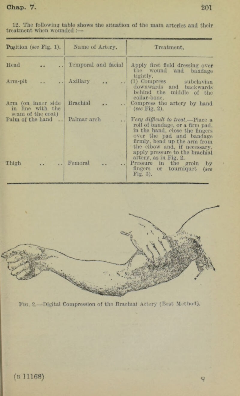 12. The following table shows the situation ot the main arteries and their treatment wiren wounded :— Poeition (see Fig. 1). Name of Artery. Treatment. Head Temporal and facial Apply first field dressing over Arm-pit A.xiilary tiu! wound and bandage tightly. (1) Compress subclavian downwards and backwards Arm (on inner side Brachial beliind tlie middle of the collar-bone. Comprc.ss the artery by hand (see Fig. 2). in line with the scam of the coat) Palm of tiic iiand .. Palmar areli Vert/ difficult to treat.—Place a Tliigh Femoral roll of bandage, or a firm pad. in the hand, close the lingers over the pad and bandage firmly, bend up the arm from the elbow and. if necessary, apply pressure to the brachial artery, as in Fig. 2. Pressure in the groin bv fingers or tourniquet (see Fig. 3). Fio. 2.—Dmital Compression ot tiio Tiraeliial .artery (Rest Methnd).