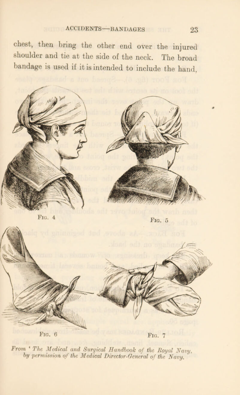 chest, then bring the other end over the injured shoulder and tie at the side of the neck. The broad bandage is used if it is intended to include the hand, Fig. 5 Fio. 7 Fig. 4 Fig. 6 From ‘ The Mediml and Siirijical Handbook of the Royal Na by permission of the Medical Director-General of the. Navy. vy.