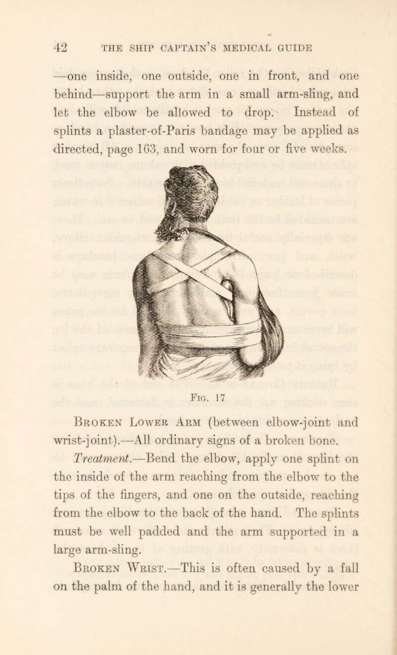 —one inside, one outside, one in front, and one behind—support the arm in a small arm-sling, and let the elbow be allowed to drop. Instead of splints a plaster-of-Paris bandage may be applied as directed, page 1G3, and worn for four or five weeks. Fig. 17 Broken Lower Arm (between elbow-joint and wrist-joint).—All ordinary signs of a broken bone. Treatment.—Bend the elbow, apply one splint on the inside of the arm reaching from the elbow to the tips of the fingers, and one on the outside, reaching from the elbow to the back of the hand. The splints must be well padded and the arm supported in a large arm-sling. Broken Wrist.—Tliis is often caused by a fall on the palm of the hand, and it is generally the lower