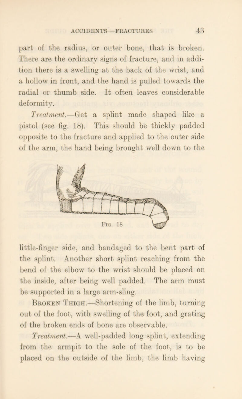 part of the radius, or outer bone, that is broken. There are the ordinary signs of fracture, and in addi- tion there is a swelling at the back of the wrist, and a hollow in front, and the hand is pulled towards the radial or thumb side. It often leaves considerable deformity. Trentmeni.—Get a splint made shaped like a pistol (see fig. 18). Tliis should be thickly padded opposite to the fracture and applied to the outer side of the arm, the hand being brought well down to the ■ 00 little-finger side, and bandaged to the bent part of the splint. Another short splint reaching from the bend of the elbow to the wrist should be placed on the inside, after being well padded. The arm must be supported in a large arm-sling. Broken Thigh.—Shortening of the limb, turning out of the foot, with swelhng of the foot, and grating of the broken ends of bone are observable. Treatment.—A well-padded long splint, extending from the armpit to the sole of the foot, is to be placed on the outside of the limb, the limb having