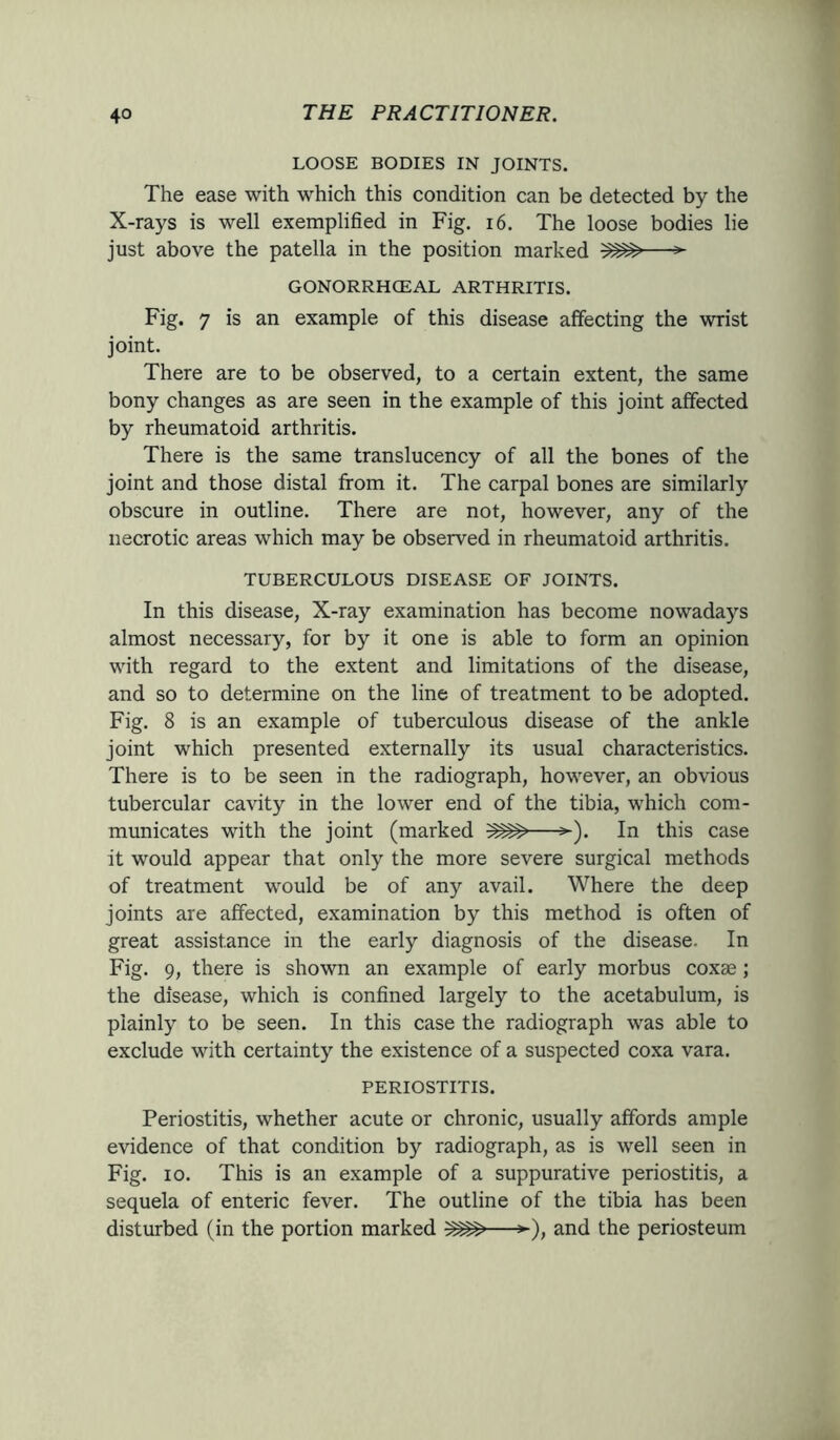 LOOSE BODIES IN JOINTS. The ease with which this condition can be detected by the X-rays is well exemplified in Fig. 16. The loose bodies lie just above the patella in the position marked ^—► GONORRHCEAL ARTHRITIS. Fig. 7 is an example of this disease affecting the wrist joint. There are to be observed, to a certain extent, the same bony changes as are seen in the example of this joint affected by rheumatoid arthritis. There is the same translucency of all the bones of the joint and those distal from it. The carpal bones are similarly obscure in outline. There are not, however, any of the necrotic areas which may be observed in rheumatoid arthritis. TUBERCULOUS DISEASE OF JOINTS. In this disease, X-ray examination has become nowadays almost necessary, for by it one is able to form an opinion with regard to the extent and limitations of the disease, and so to determine on the line of treatment to be adopted. Fig. 8 is an example of tuberculous disease of the ankle joint which presented externally its usual characteristics. There is to be seen in the radiograph, however, an obvious tubercular cavity in the lower end of the tibia, which com- municates with the joint (marked ^—*-). In this case it would appear that only the more severe surgical methods of treatment would be of any avail. Where the deep joints are affected, examination by this method is often of great assistance in the early diagnosis of the disease. In Fig. 9, there is shown an example of early morbus coxae; the disease, which is confined largely to the acetabulum, is plainly to be seen. In this case the radiograph was able to exclude with certainty the existence of a suspected coxa vara. PERIOSTITIS. Periostitis, whether acute or chronic, usually affords ample evidence of that condition by radiograph, as is well seen in Fig. io. This is an example of a suppurative periostitis, a sequela of enteric fever. The outline of the tibia has been disturbed (in the portion marked ^—►), and the periosteum
