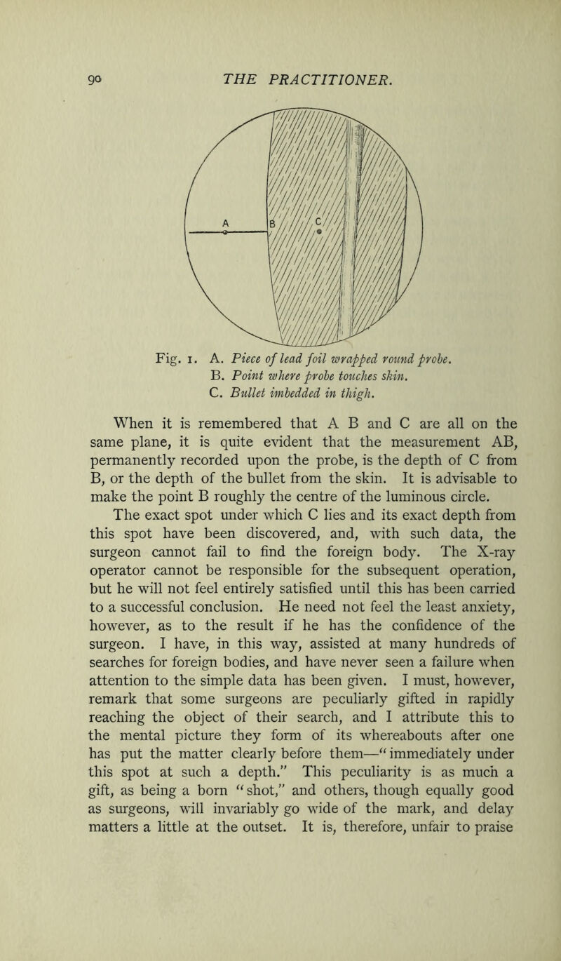 Fig. i. A. Piece of lead foil wrapped round prole. B. Point where probe touches skin. C. Bullet imbedded in thigh. When it is remembered that A B and C are all on the same plane, it is quite evident that the measurement AB, permanently recorded upon the probe, is the depth of C from B, or the depth of the bullet from the skin. It is advisable to make the point B roughly the centre of the luminous circle. The exact spot under which C lies and its exact depth from this spot have been discovered, and, with such data, the surgeon cannot fail to find the foreign body. The X-ray operator cannot be responsible for the subsequent operation, but he will not feel entirely satisfied until this has been carried to a successful conclusion. He need not feel the least anxiety, however, as to the result if he has the confidence of the surgeon. I have, in this way, assisted at many hundreds of searches for foreign bodies, and have never seen a failure when attention to the simple data has been given. I must, however, remark that some surgeons are peculiarly gifted in rapidly reaching the object of their search, and I attribute this to the mental picture they form of its whereabouts after one has put the matter clearly before them—■“ immediately under this spot at such a depth.” This peculiarity is as much a gift, as being a born “ shot,” and others, though equally good as surgeons, will invariably go wide of the mark, and delay matters a little at the outset. It is, therefore, unfair to praise