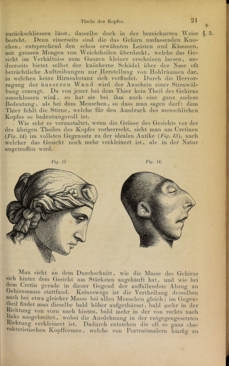 ziirückschliessen lässt, dasselbe doch in der bezeiclmcten AVeise §.3. besteht. Denn einerseits sind die das Gehirn umfassenden Kno- chen, entsprechend den schon erwähnten Leisten und Kämmen, mit grossen Mengen von AVeichtheilen überdeckt, Avelche das Ge- sicht im Verliältniss zum Ganzen kleiner erscheinen lassen, an- drerseits bietet selbst der knöcherne Schädel über der Nase oft beträchtliche Auftreibungen zur Herstellung von Hohlräumen dar, in welchen keine Hirnsubstanz sich vorfindet. Dui-ch die Hervor- rairuns der äusseren Wand wird der Anschein einer Stirnwöl- billig erzeugt. Da von jener bei dem Thier kein Theil des Gehirns umschlossen wird, so hat sie bei ihm auch eine ganz andere Bedeutung, als bei dem Alenschen , so dass man sagen darf: dem Thier fehlt die Stirne, welche für den Ausdruck des menschlichen Kopfes so bedeutungsvoll ist. AVie selir es verunstaltet, wenn die Grösse des Gesichts vor der des übrigen Theiles des Kopfes vorherrscht, sieht man am Cretinen {Fi(/. 14) im vollsten Gegensatz zu der idealen Antike (FiV/. Vi), nach welcher das Gesicht noch mehr verkleinert ist, als in der Natur angctrofi’en wird. FUj. 13 FUj. u, Man sieht an dem Durchschnitt, wie die Alasse des Gehirns sich hinter dem Gesicht am Stärksten angehäuft liat, und wie bei dem Cretin gerade in dieser Gegend der autrallendste Abzug an Gehirnmasse stattfand. Keineswegs ist die Aertheilung derselben auch bei etwa gleicher Alasse bei allen Alenschen gleich; im (iegen- ^leil findet man dieselbe bald liöher aufgethürmt, bald mehr in der Richtung von vorn nach hinten, bald mehr in der von rechts nacli hiiks ausgebreitet, Avobei die Ausdehnung in der entgegengesetzten Richtung verkleinert ist. Dadurch entstehen die oft so ganz cha- rakteristischen Kopfformen, welche von Portraitmalcrn liiüifig zu