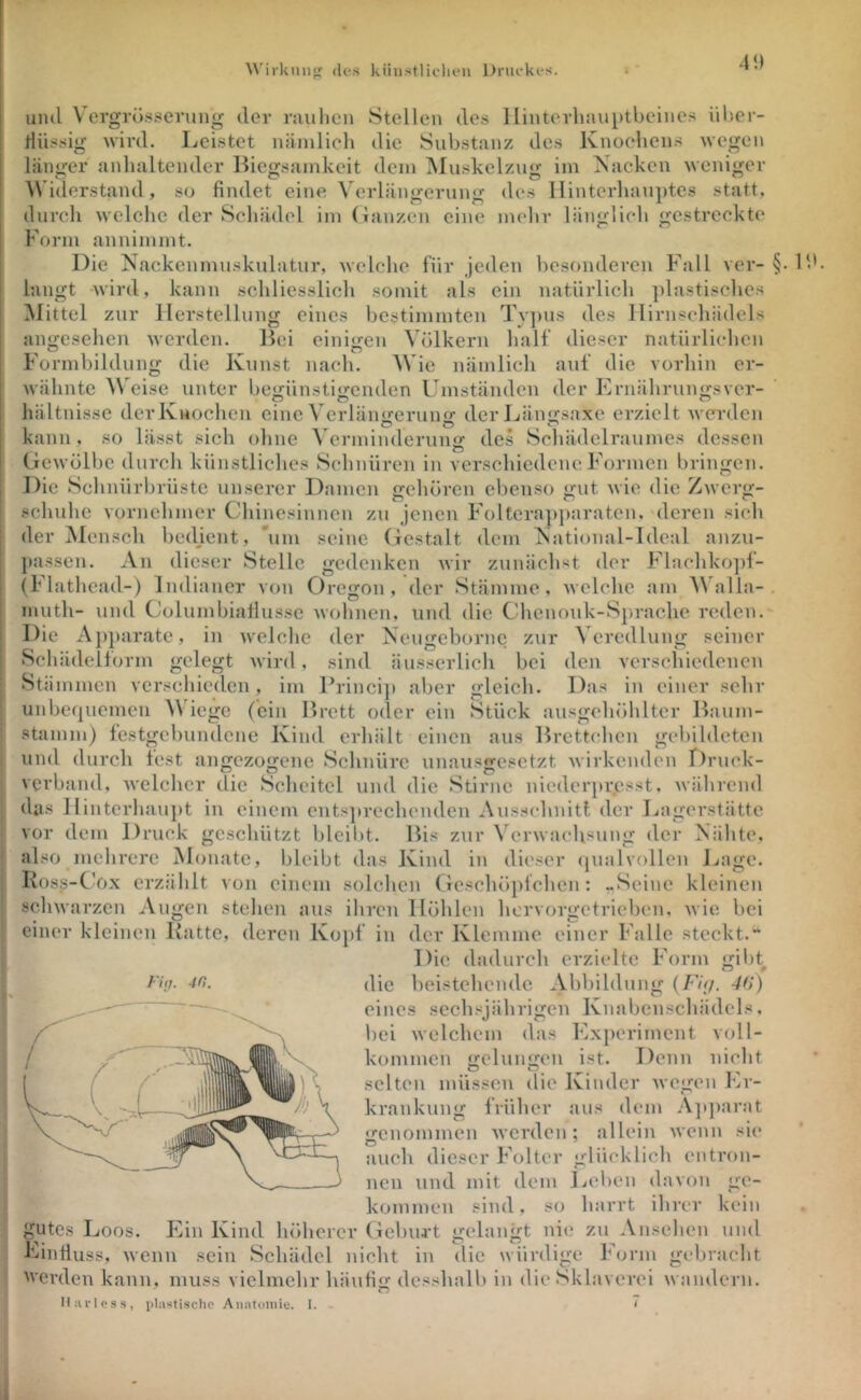 \\'irkiui{>: des künstlichen Dniekes. 4<) und V’crgrösseriiiig der rnulien Stellen des Ilinterlnuiptbeines iiher- lliissig wird. Leistet nämlich die Substanz des Knochens wegen länger anhaltender Biegsamkeit dem Muskelzug im Kacken weniger ^^'iderstand, so findet eine Verlängerung des llinterlian])tes statt, durch welche der Schädel im (lanzen eine mehr länglich gestreckte Form annimmt. Die Nackenmuskulatur, welche für jeden besonderen Fall ver- { langt wird, kann schliesslich somit als ein natürlich plastisches Büttel zur Herstellung eines bestimmten Typus des llirnschädels angesehen werden. Bei einiiren Völkern half dieser natürlichen Formhildung die Kunst nach. Wie nämlich auf die vorhin er- wähnte Weise unter begünstigenden Umständen der Ernährungsver- hältnisse derKnochen eine Verlängerung)’ derl^ängsaxe erzielt werden kann , so lässt sich ohne Verminderung des Schädelraumes dessen Gewölbe durcli künstliches Schnüren in verschiedene Formen bringen. Die Schnürbrüste unserer Damen gehören ebenso gut wie die Zwerg- schuhe vornehmer Chinesinnen zu jenen Folterapj)araten, deren sich der Mensch bedjent, *um seine Gestalt dem National-Ideal anzu- jtassen. An dieser Stelle gedenken wir zunächst der Flachko])!- (Flathead-) Indianer von Oregon, der Stämme, welche am ^Nalla-. niuth- und Columbiafiusse wolinen, und die Chenonk-Sp,rache reden. Die Aj)])arate, in welche der Neugeborne zur Veredlung seiner Schädelform gelegt wird, sind äusserlich bei den verschiedenen Stä mmen verschieden, im Princi]i aber gleich. Das in einer sehr unbequemen ^\ iege (ein Brett oder ein Stück ansgehöhlter Baum- stamm) festgebundene Kind erhält einen aus Brettchen gebildeten und durch fest angezogene Schnüre unaiisgcsetzt wirkenden r)rnck- verband, welcher die Scheitel und die Stirne niederpresst, währeml das 11interhau})t in einem ents])rechenden Ausschnitt der Lagerstätte vor dem Druck geschützt blcil)t. Bis zur Verwachsung der Nähte, also mehrere Monate, bleibt das Kind in dieser qualvollen J./age. Koss-C'ox erzählt von einem solchen Gcschöpichen : -Seine kleinen scliwarzen Augen stehen ans ihren Höhlen hervorgetrieben, wie bei einer kleinen Hatte, deren Ko[)f in der Klemme einer Falle steckt.“ Die dadurch erzielte Form gibt die heistehende Abbildung {Fi;/. 4()) eines sechsjährigen Knabcnscliädels, bei welchem das Experiment voll- kommen gelungen ist. Denn nicht selten müssen die Kinder Avegen Er- krankung früher aus dem A]q)arat genommen Averden; allein Avenn si(' auch dieser Folter glücklich entron- nen und mit dem Leben davon ge- kommen sind, so harrt ihrer kein gutes Loos. Ein Kind höherer Geburt gelangt nie zu Ansehen und Lintiuss, Avenn sein Schädel nicht in clic würdige Form gebracht Werden kann, muss vielmehr häiifig dcsshalb in die Sklaverei Avandern. Ilurloss, \)U<sti.sclic Anntouiie. 1. <