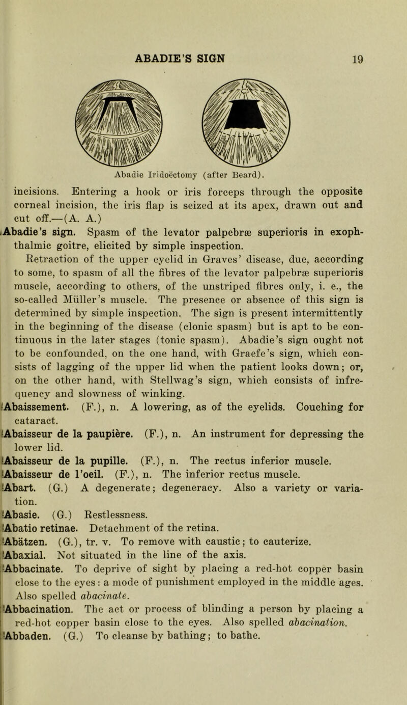 Abadie Iridoectomy (after Beard). incisions. Entering a hook or iris forceps through the opposite corneal incision, the iris flap is seized at its apex, drawn out and cut off.—(A. A.) I Abadie’s sign. Spasm of the levator palpebrae superioris in exoph- thalmic goitre, elicited by simple inspection. Retraction of the upper eyelid in Graves’ disease, due, according to some, to spasm of all the fibres of the levator palpebrte superioris muscle, according to others, of the unstriped fibres only, i. e., the so-called Muller’s muscle. The presence or absence of this sign is determined by simple inspection. The sign is present intermittently in the beginning of the disease (clonic spasm) but is apt to be con- tinuous in the later stages (tonic spasm). Abadie’s sign ought not to be confounded, on the one hand, with Graefe’s sign, which con- sists of lagging of the upper lid when the patient looks down; or, on the other hand, with Stellwag’s sign, which consists of infre- quency and slowness of winking. ;Abaissement. (P.), n. A lowering, as of the eyelids. Couching for cataract. lAbaisseur de la paupiere. (F.), n. An instrument for depressing the lower lid. lAbaisseur de la pupille. (F.), n. The rectus inferior muscle. lAbaisseur de I’oeil. (P.), n. The inferior rectus muscle, lAbart. (G.) A degenerate; degeneracy. Also a variety or varia- tion. lAbasie. (G.) Restlessness. lAbatio retinae. Detachment of the retina. •Abatzen. (G.), tr. v. To remove with caustic; to cauterize. •Abaxial. Not situated in the line of the axis. i*Abbacinate. To deprive of sight by placing a red-hot copper basin 1 close to the eyes: a mode of punishment employed in the middle ages. Also spelled ahacinate. IAbbacination. The act or process of blinding a person by placing a I red-hot copper basin close to the eyes. Also spelled ahacination. [Abbaden. (G.) To cleanse by bathing; to bathe.