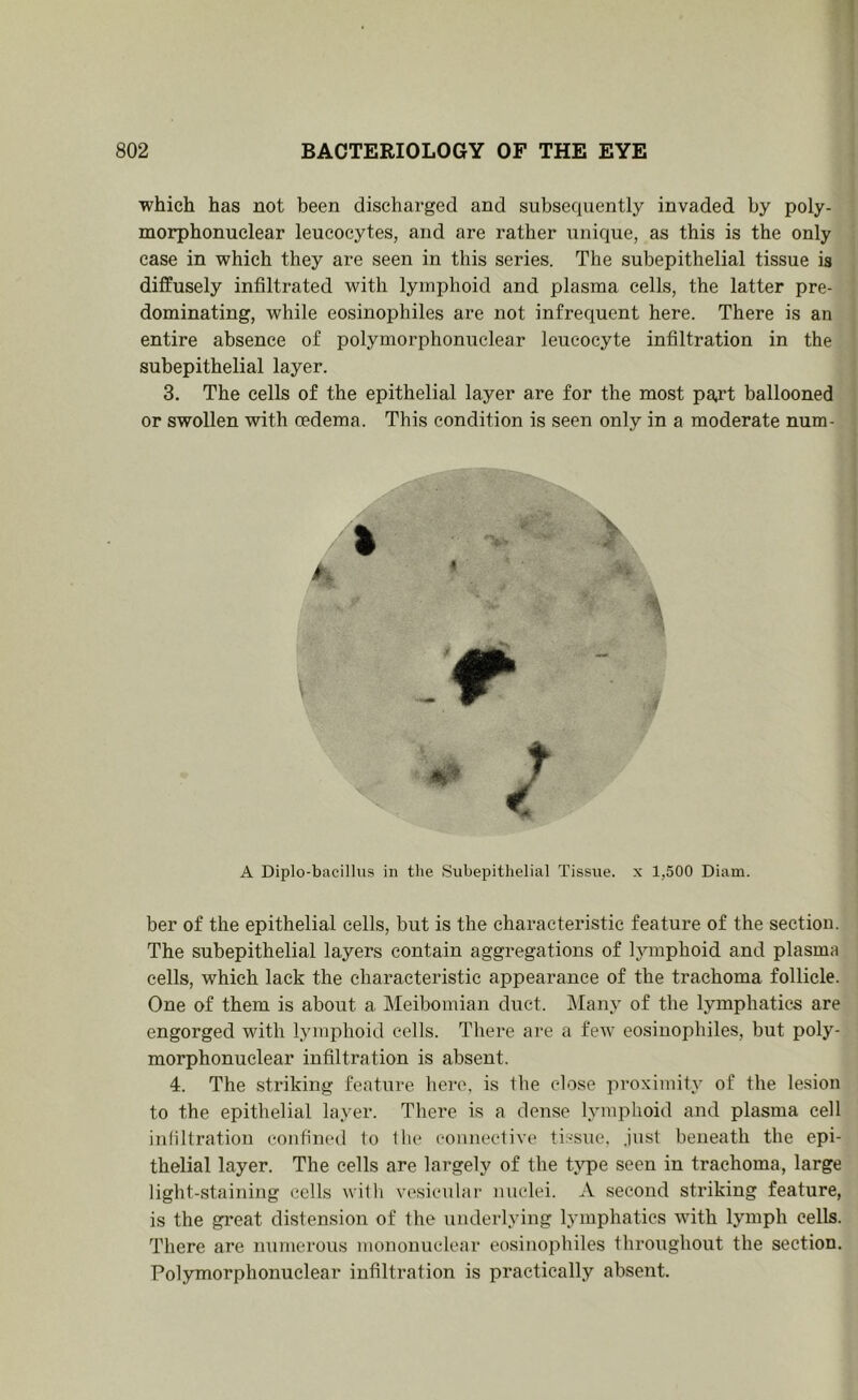 which has not been discharged and subsequently invaded by poly- morphonuclear leucocytes, and are rather iinique, as this is the only case in which they are seen in this series. The subepithelial tissue is diffusely infiltrated with lymphoid and plasma cells, the latter pre- dominating, while eosinophiles are not infrequent here. There is an entire absence of polymorphonuclear leucocyte infiltration in the subepithelial layer. 3. The cells of the epithelial layer are for the most pajt ballooned or swollen with oedema. This condition is seen only in a moderate num- A Diplo-bacilliis in tlie Subepithelial Tissue, x 1,500 Diam. ber of the epithelial cells, but is the characteristic feature of the section. The subepithelial layers contain aggregations of lymphoid and plasma cells, which lack the characteristic appearance of the trachoma follicle. One of them is about a Meibomian duct. Many of the lymphatics are engorged with lymphoid cells. There are a few eosinophiles, but poly- morphonuclear infiltration is absent. 4. The striking feature here, is the close proximity of the lesion to the epithelial layer. There is a dense lymphoid and plasma cell infiltration eonfined to the connective tissue, .just beneath the epi- thelial layer. The cells are largely of the t^qje seen in trachoma, large light-staining cells willi vesicular nuclei. A second stinking feature, is the great distension of the underlying lymphatics with lymph cells. There are numerous mononuclear eosinophiles throughout the section. Polymorphonuclear infiltration is practically absent.