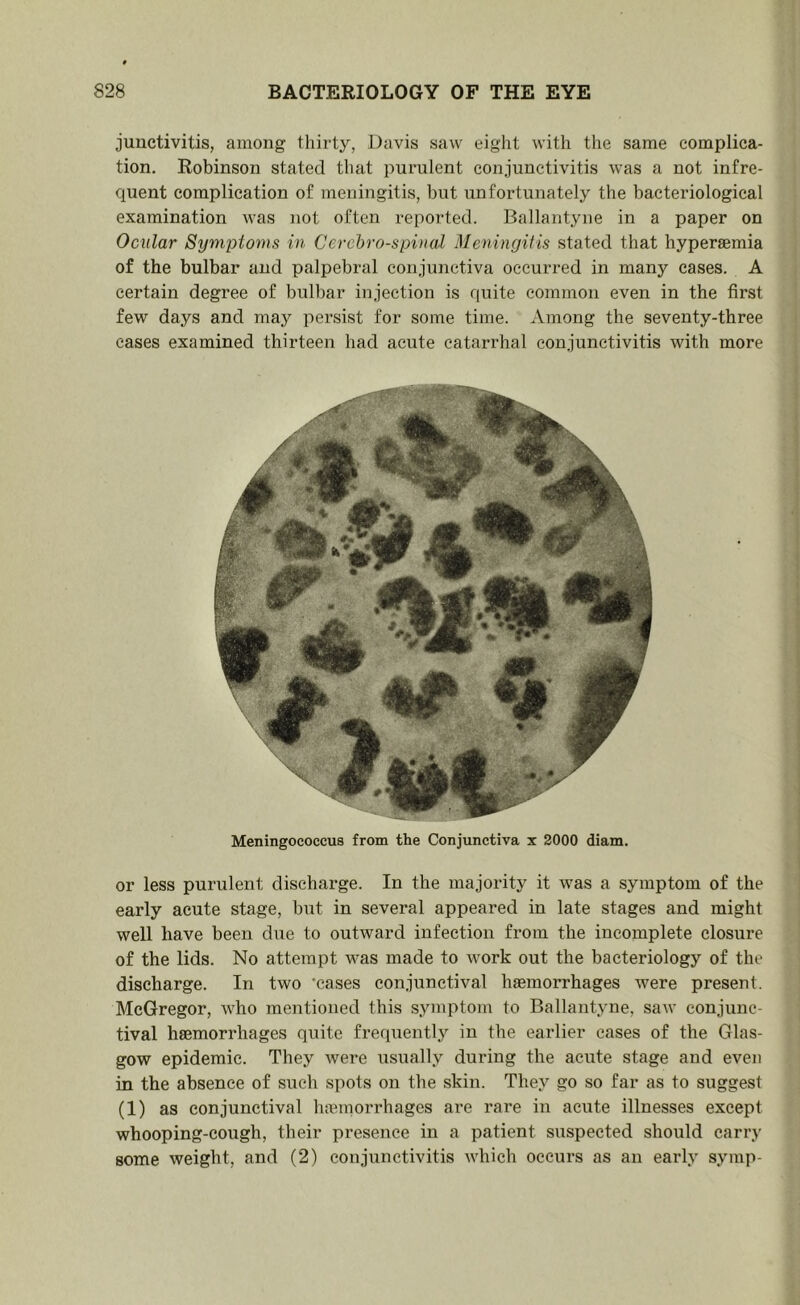 junctivitis, among thirty, Davis saw eight with the same complica- tion. Robinson stated that purulent conjunctivitis was a not infre- quent complication of meningitis, but unfortunately the bacteriological examination was not often reported. Ballantyne in a paper on Ocular Symptoms in Cerebrospinal Meningitis stated that hyperaemia of the bulbar and palpebral conjunctiva occurred in many cases. A certain degree of bulbar injection is quite common even in the first few days and may persist for some time. Among the seventy-three cases examined thirteen had acute catarrhal conjunctivitis with more Meningococcus from the Conjunctiva x 2000 diam. or less purulent discharge. In the majority it was a symptom of the early acute stage, but in several appeared in late stages and might well have been due to outward infection from the incomplete closure of the lids. No attempt was made to work out the bacteriology of the discharge. In two 'cases conjunctival hsemorrhages were present. McGregor, who mentioned this symptom to Ballantyne, saw conjunc- tival haemorrhages quite frequentlj^ in the earlier eases of the Glas- gow epidemic. They were usually during the acute stage and even in the absence of such spots on the skin. They go so far as to suggest (1) as conjunctival lunmorrhages are rare in acute illnesses except whooping-cough, their presence in a patient suspected should carry some weight, and (2) conjunctivitis which occurs as an early symp-