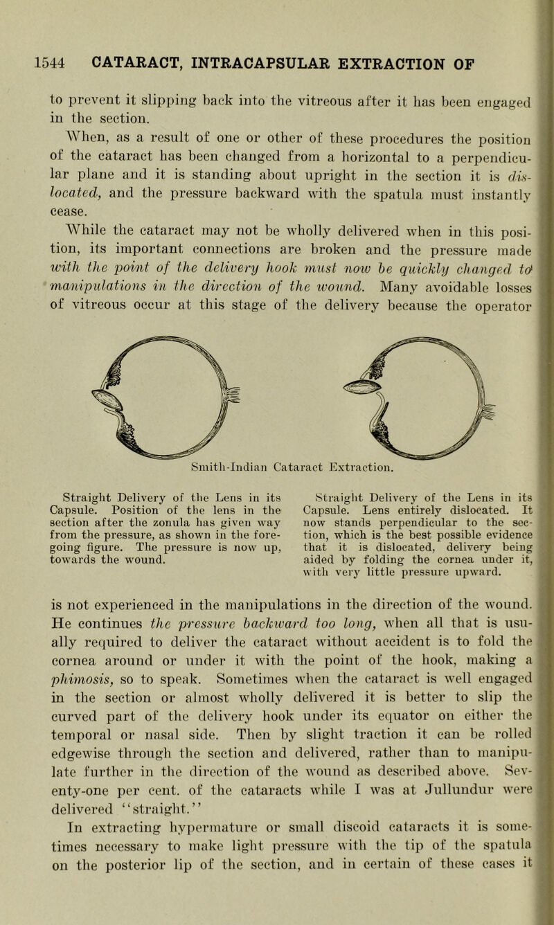 1o prevent it slipping back into the vitreous after it has been engaged in the section. When, as a result of one or other of these procedures the position of the cataract has been changed from a horizontal to a perpendicu- lar plane and it is standing about upright in the section it is dis- located, and the pressure backward with the spatula must instantly cease. While the cataract may not be wholly delivered when in this posi- tion, its important connections are broken and the pressure made with the point of the delivery hook must now he quickly changed, td manipulations in the direction of the wound. Many avoidable losses of vitreous occur at this stage of the delivery because the operator Smitli-Iridian Cataract Extraction. Straight Delivery of the Lens in its Capsule. Position of the lens in the section after the zonula has given way from the pressure, as shown in the fore- going figure. The pressure is now up, towards the wound. Straight Delivery of the Lens in its Capsule. Lens entirely dislocated. It now stands perpendicular to the sec- tion, which is the best possible evidence that it is dislocated, delivery being aided by folding the cornea under it, with very little pressure upward. is not experienced in the manipulations in the direction of the wound. He continues the pressure backward too long, when all that is usu- i ally required to deliver the cataract without accident is to fold the ; cornea, around or under it with the point of the hook, making a phimosis, so to speak. Sometimes when the cataract is well engaged | in the section or almost wholly delivered it is better to slip the ! curved part of the delivery hook under its e(iuator on either the | temporal or nasal side. Then by slight traction it can be rolled edgewise through the section and delivered, rather than to manipu- late further in the direction of the wound as described above. Sev- ; enty-one per cent, of the cataracts while I was at Jullundur were delivered “straight.” In extracting hypermature or small discoid cataracts it is some- times necessary to make light pressure with the tip of the spatula on the posterior lip of the section, and in certain of these cases it