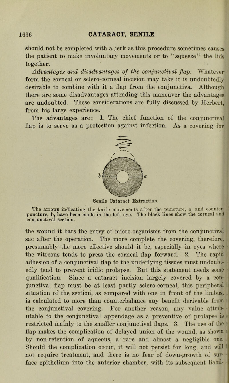 should not be completed with a jerk as this procedure sometimes causes the patient to make involuntary movements or to “squeeze” the lids together. Advantages and disadvantages of the conjunctival flap. Whatever form the corneal or sclero-corneal incision may take it is undoubtedly desirable to combine with it a flap from the conjunctiva. Although there are some disadvantages attending this maneuver the advantages are undoubted. These considerations are fully discussed by Herbert, from his large experience. The advantages are: 1. The chief function of the conjunctival flap is to serve as a protection against infection. As a covering for I Senile Cataract Extraction. The arrows indicating the knife movements after the puncture, a, and counter- puncture, b, have been made in the left eye. The black lines show the corneal and conjunctival section. the wound it bars the entry of micro-organisms from the conjunctival sac after the operation. The more complete the covering, therefore, presumably the more effective should it be, especially in eyes where the vitreous tends to press the corneal flap forward. 2. The rapid adhesion of a conjunctival flap to the underlying tissues must undoubt- edlj'’ tend to prevent iridic prolapse. But this statement needs some ■ qualiflcation. Since a cataract incision largely covered by a con- junctival flap must be at least partly sclero-corneal, this peripheral situation of the section, as compared with one in front of the limbus. . is calculated to more than counterbalance any benefit derivable from the conjunctival covering. For another reason, any value attrib- utable to the conjunctival appendage as a preventive of prolapse is > restricted mainly to the smaller conjunctival flaps. 3. The use of the flap makes the complication of delayed union of the wound, as shown by non-retention of aqueous, a rare and almost a negligible one. j Should the complication occur, it will not persist for long, and will j not require treatment, and there is no fear of down-growth of sur- j face epithelium into the anterior chamber, with its subsequent liabil- j