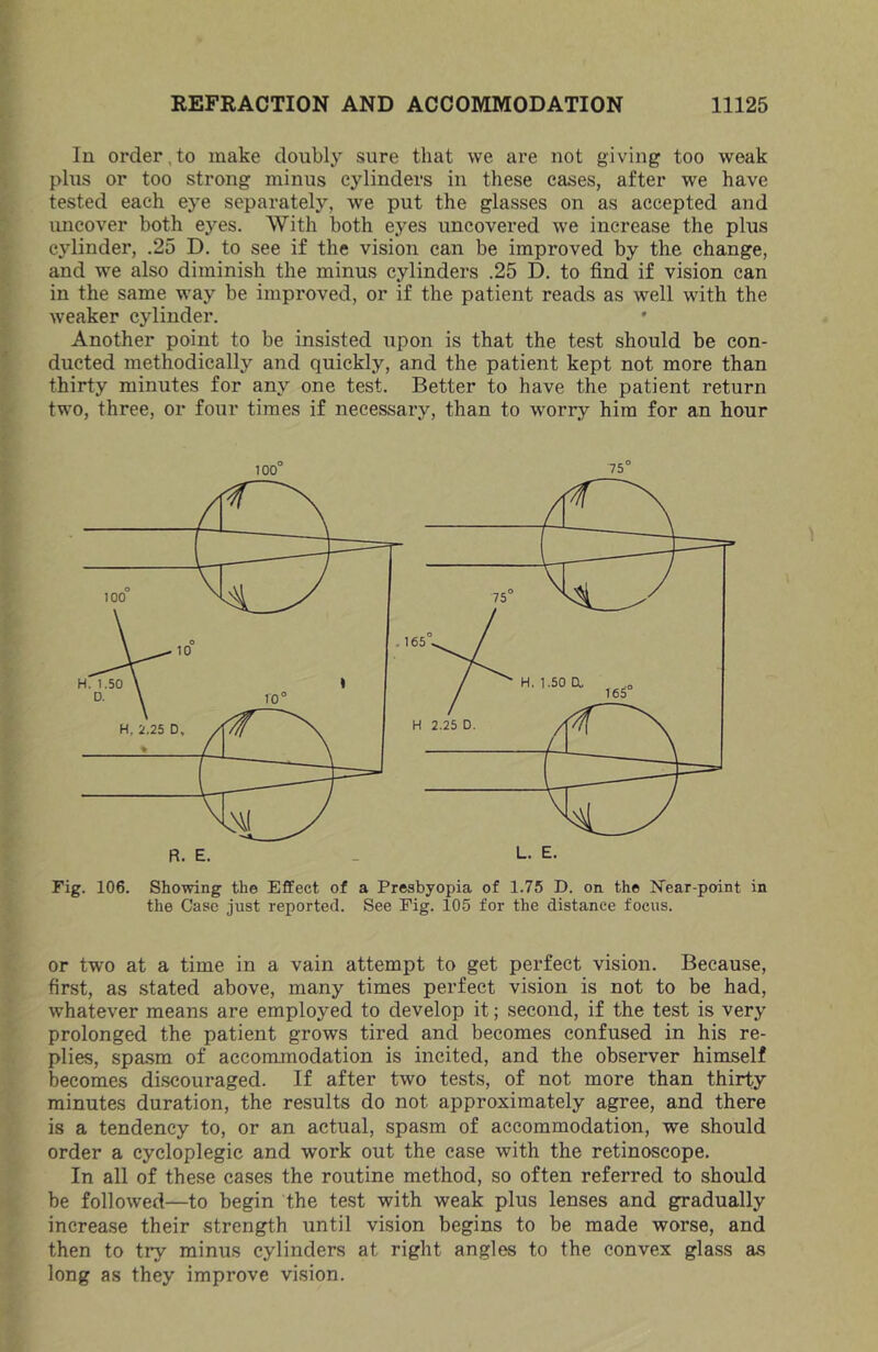 In order,to make doubly sure that we are not giving too weak plus or too strong minus cylinders in these cases, after we have tested each eye separately, we put the glasses on as accepted and imcover both eyes. With both eyes uncovered we increase the plus cylinder, .25 D. to see if the vision can be improved by the change, and we also diminish the minus cylinders .25 D. to find if vision can in the same way be improved, or if the patient reads as well with the weaker cylinder. Another point to be insisted upon is that the test should be con- ducted methodically and quickly, and the patient kept not more than thirty minutes for any one test. Better to have the patient return two, three, or four times if necessary, than to worry him for an hour 75° 100° L. E. R. E. Fig. 106. Showing the Effect of a Presbyopia of 1.75 D. on the Near-point in the Case just reported. See Pig. 105 for the distance focus. or two at a time in a vain attempt to get perfect vision. Because, first, as stated above, many times perfect vision is not to be had, whatever means are employed to develop it; second, if the test is very prolonged the patient grows tired and becomes confused in his re- plies, spasm of accommodation is incited, and the observer himself becomes discouraged. If after two tests, of not more than thirty minutes duration, the results do not approximately agree, and there is a tendency to, or an actual, spasm of accommodation, we should order a cycloplegic and work out the case with the retinoscope. In all of these cases the routine method, so often referred to should be followed—to begin the test with weak plus lenses and gradually increase their strength until vision begins to be made worse, and then to try minus cylinders at right angles to the convex glass as long as they improve vision.