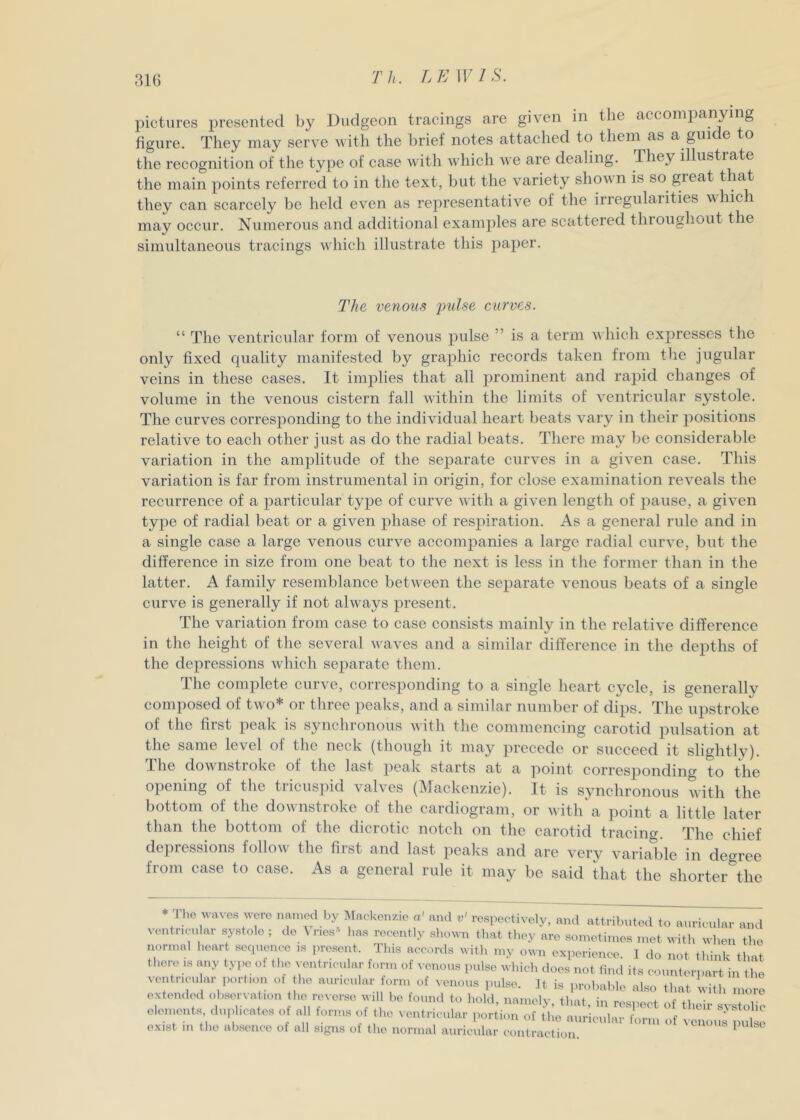 31G pictures presented by Dudgeon tracings are given in the accoinj)anying figure. They may serve Avith the brief notes attached to them as a guide to the recognition of the type of case with which we are dealing. They illustrate the main jioints referred to in the text, but the variety shown is so great that they can scarcely be held even iis representative of the irregularities vhich may occur. Numerous and additional examples are scattered throughout the simultaneous tracings which illustrate this paper. The venous 'pulse curves. “ The ventricular form of venous pulse ” is a term which expresses the only fixed quality manifested by graphic records taken from the jugular veins in these cases. It implies that all prominent and rapid changes of volume in the venous cistern fall within the limits of ventricular systole. The eurves corresponding to the individual heart beats vary in their positions relative to each other just as do the radial beats. There may be considerable variation in the amplitude of the separate curves in a given case. This variation is far from instrumental in origin, for close examination reveals the recurrence of a particular type of curve with a given length of pause, a given type of radial beat or a given phase of respiration. As a general rule and in a single case a large venous curve accompanies a large radial curve, but the difference in size from one beat to the next is less in the former than in the latter. A family resemblance between the separate venous beats of a single curve is generally if not ahvays present. The variation from case to case consists mainly in the relative difference in the height of the several waves and a similar difference in the depths of the depressions which separate them. The complete curve, corresponding to a single heart cycle, is generally composed of two* or three peaks, and a similar number of dips. The upstroke of the first peak is synchronous with the commencing carotid pulsation at the same level of the neck (though it may precede or succeed it slightly). Hie downstroke of the last peak starts at a point corresjionding to the opening of the tricus]iid valves (Mackenzie). It is synchronous with the bottom of the downstroke of tlie cardiogram, or with a point a little later than the bottom of the dicrotie notch on the carotid tracing. The chief depressions follow the first and last jieaks and are very variable in degree from case to case. As a general rule it may be said that the shorter the * The uavos were nainod l)y I^Iackenzio a' and v' respectively, and attrilnited to aurici ventncidar systole ; do Vries has recently shown that they are sometimes met with w