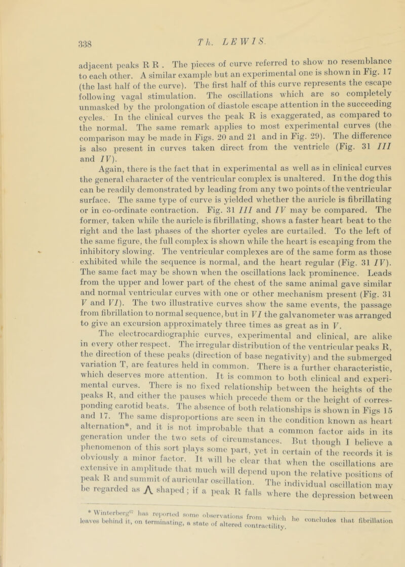 adjacent peaks R R . The pieces of curve referred to sliovv no resemblance to each other. A similar example but an exi)erimental one is shovn in Fig. 17 (the last half of the curve). The first half of this curve represents the escape following vagal stimulation. The oscillations which are so comj)letely unmasked by the prolongation of diastole escajie attention in the succeeding cycles. In the clinical curves tlie peak R is exaggerated, as compared to the normal. The same remark applies to most experimental curves (the comparison may be made in Figs. 20 and 21 and in Fig. 29). The difference is also present in curves taken direct from the ventricle (Fig. 31 III and IV). Again, there is the fact that in experimental as well as in clinical curves the general character of the ventricular complex is unaltered. In the dog this can be readily demonstrated by leading from any two pointsof the ventricular surface. The same type of curve is yielded whether the auricle is fibrillating or in co-ordinate contraction. Fig. 31 III and IV may be compared. The former, taken while the auricle is fibrillating, shows a faster heart beat to the right and the last phases of the shorter cycles are curtailed. To the left of the same figure, the full complex is shown while the heart is escaping from the inhibitory slowing. The ventricular complexes are of the same form as those exhibited while the seciuence is normal, and the heart regular (Fig. 31 IV). The same fact may be shown when the oscillations lack prominence. Leads from the upper and lower part of the chest of the same animal gave similar and normal ventricular curves with one or other mechanism present (Fig. 31 V and VI). The two illustrative curves show the same events, the passage from fibrillation to normal ser[uence,but in VI the galvanometer was arranged to give an excursion approximately three times as great as in V. The electrocardiographic curves, experimental and clinical, are alike in every other respect. The irregular distribution of the ventricular peaks R, the direction of these peaks (direction of base negativity) and the submerged variation T, are features lield in common. There is a further characteristic, which deserves more atRntion. It is common to both clinical and experi- mental curves. There is no fixed relationship between the heights of the peaks R, and eitlier tlie jiauses M hicii ])recede tliem or the height of corres- ponding carotid beats. The absence of botli relationshii.s is shown in Figs 15 and 1/ I he same disproportions are seen in the condition known as heart alternation*, and it is not improi.able tliat a common factor aids in its geneiation under tlie two sets of eircunistances. Rut though 1 believe a ,>henonienon of this sort plays some part, yet in certain of the records it is obviously a minor factor. It will be clear that when the oscillations are nean'l'^u'dsr’’ r ^ relative positions of e e.arde .17 1 imlividual oscillation mav be Kgaided as A shaped ; if a peak R falls where the depression between * VViiitorl) berg'' htifi reiioried some observations from • i i leaves bol.iml it, on terminating, a state of altered eontraetilitv. fibrillation