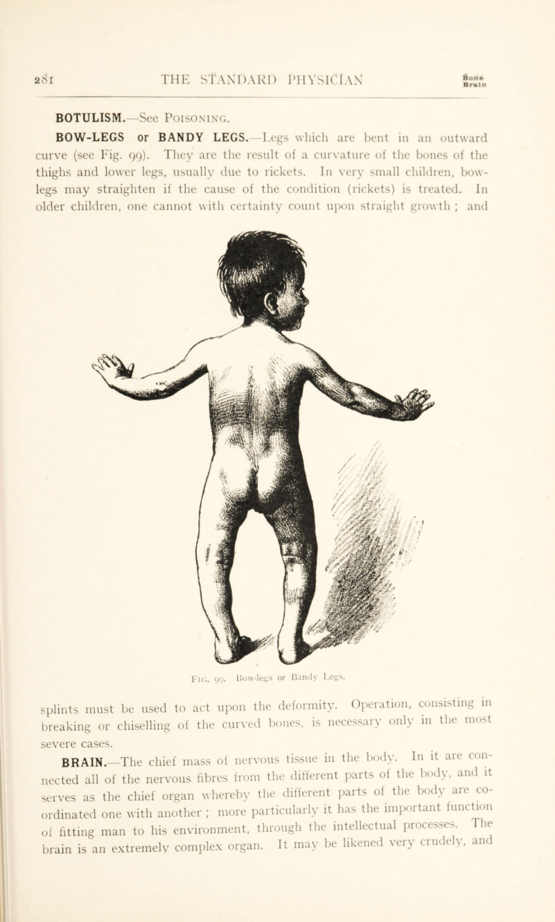 Brain BOTULISM.—See Poisoning. BOW-LEGS or BANDY LEGS.—Legs which are l)ent in an outward curve (see Fig. 99). They arc the result of a curvature of the l)oues of the thighs and lower legs, usually due to rickets. lu very small children, how- legs may straighten if the cause of the condition (rickets) is treated. In older children, one cannot with certainty count upon straight growth ; and Fic. 90. Uow-legs or liandy Legs. splints must be used to act upon the deformity. Operation, consisting m breaking or chiselling of the curved bones, is necessary only in the most severe cases. BRAIN.—The chief mass of nervous tissue in the liody. In it are con- nected all of the nervous fibres from the different jiarts of the body, and it serves as the chief organ whereby the different parts of the body are co- ordinated one with another ; more particularly it has the important function of fitting man to his environment, through the intellectual processes. The brain is an e.vtremely complex organ. It may be likened very crudely, and