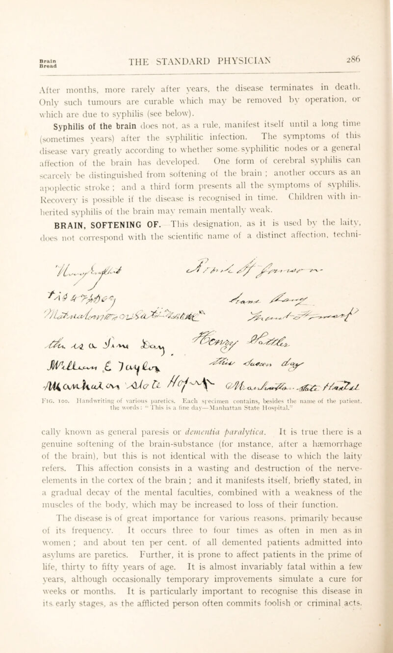 Bread 286 After months, more rareh’ after years, the disease terminates in death. Only such tumours are curable which may be removed by opeiation, 01 which are due to syphilis (see below). Syphilis of the brain does not, as a rule, manilest itselt until a long time (sometimes years) after the syphilitic infection. The symptoms of this disease vary greatlv according to whether some, syphilitic nodes or a general affection of the brain has developed. One form of cerebral syj)hilis can scarcely be distinguished from soltening ot the brain ; anothei occuis as an a]M)plectic stroke ; and a third form ]n-esents all the symptoms ot svphihs. Recovery is ]K)ssible if the disease is recognised in time. Children with in- herited sy])hilis of the brain may remain mentally weak. BRAIN, SOFTENING OF. This designation, as it is used by the laity, does not correspond with the scientilic name ol a distinct affection, teclmi- A'T' I'lG. TOO. ]!aiidwritinqof various i)aretics. Kach si ecimen contains, Ixisides tin; name of tlu* i)atient. the words; ■''I'liis is a fine day—Manhattan State Hospital. cally known as general jniresis or dcnit’iiiia pavidytica. It is true there is a genuine softening of the brain-sul)stance (for instance, after a luemorrhage of the brain), but this is not identical with the disea.se to which the laity refers. This affection consists in a wasting and destruction of the ner\'e- clemcnts in the cortex of the brain ; and it manifests itself, bricfl}’ stated, in a gradual decay of the mental faculties, combined with a weakness of the muscles of the body, which may be increased to loss of their function. The disease is of great importance for various reasons. ]:)rimarily because of its frequency. It occurs three to four times as often in men as in women ; and about ten per cent, of all demented ])atients admitted into asvlums are paretics. Eurther, it is prone to affect patients in the ])rime of life, thirty to fifty years of age. It is almost invariably fatal within a few years, although occasionally temporary improvements simulate a cure for weeks or months. It is particularly important to recognise this disease in its. early stages, as the afflicted person often commits foolish or criminal acts.