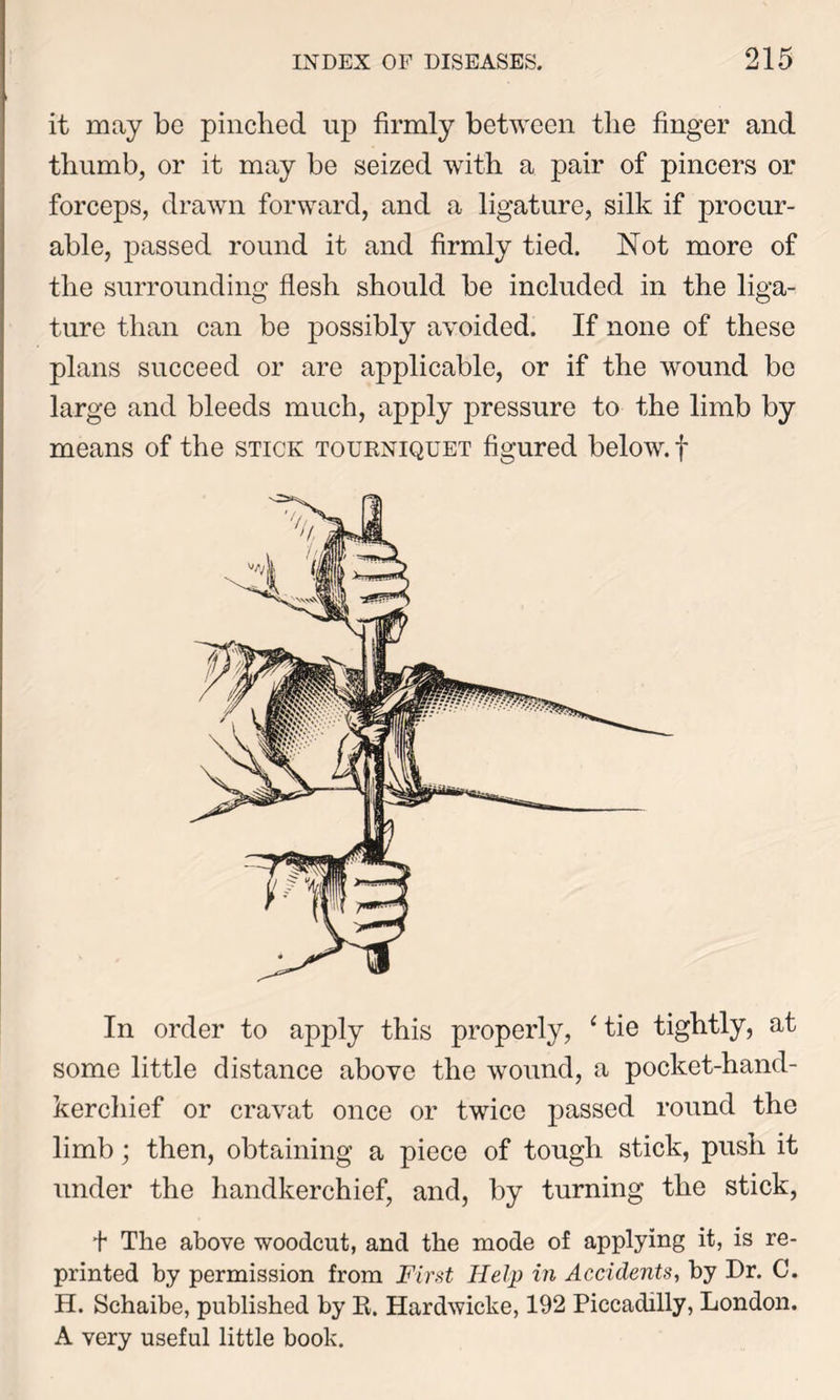 it may be pinched up firmly between the finger and thumb, or it may be seized with a pair of pincers or forceps, drawn forward, and a ligature, silk if procur- able, passed round it and firmly tied. Not more of the surrounding flesh should be included in the liga- ture than can be possibly avoided. If none of these plans succeed or are applicable, or if the wound be large and bleeds much, apply pressure to the limb by means of the stick tourniquet figured below, f In order to apply this properly, ‘tie tightly, at some little distance above the wound, a pocket-hand- kerchief or cravat once or twice passed round the limb; then, obtaining a piece of tough stick, push it under the handkerchief, and, by turning the stick, t The above woodcut, and the mode of applying it, is re- printed by permission from First Help in Accidents, by Dr. C. H. Schaibe, published by R. Hardwicke, 192 Piccadilly, London. A very useful little book.