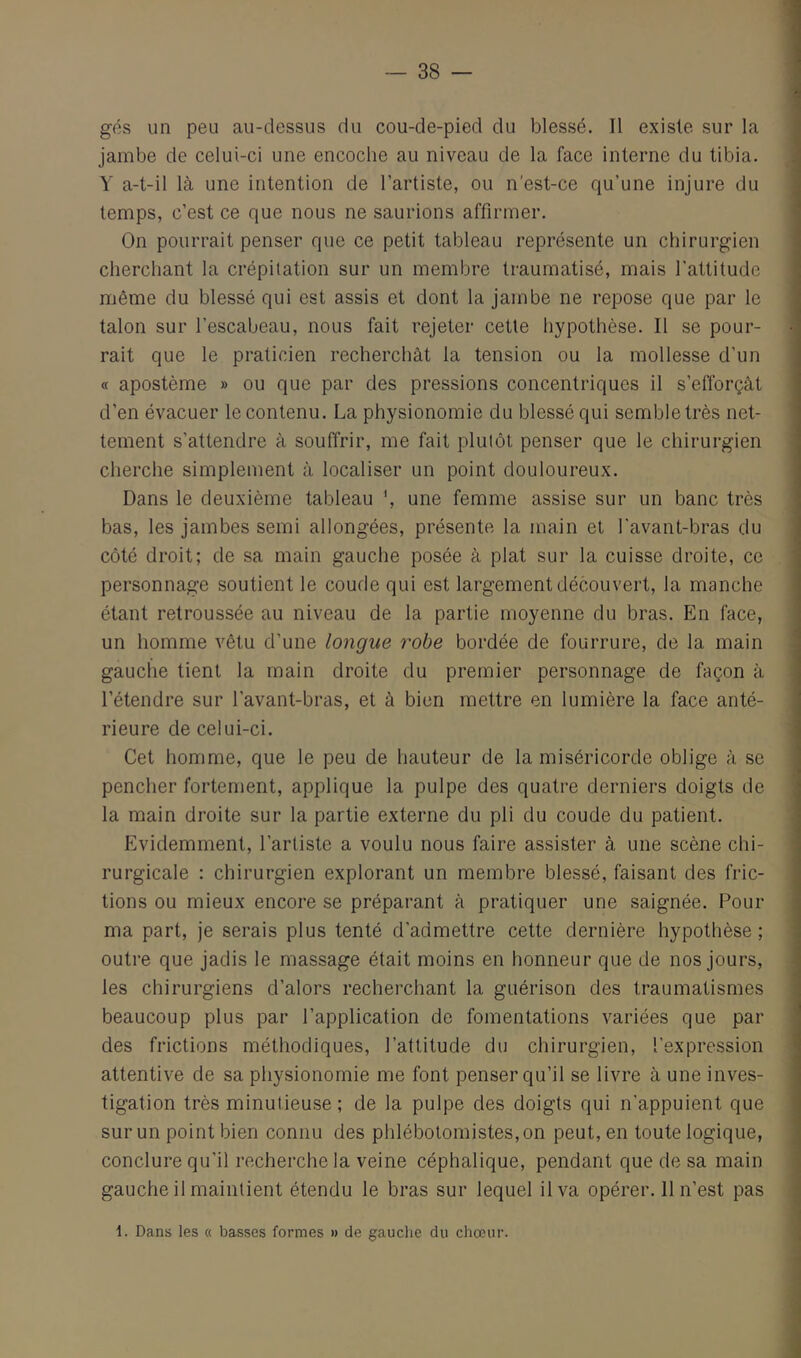 gés un peu au-dessus du cou-de-pied du blessé. Il existe sur la jambe de celui-ci une encoche au niveau de la face interne du tibia. Y a-t-il là une intention de l’artiste, ou n'est-ce qu’une injure du temps, c’est ce que nous ne saurions affirmer. On pourrait penser que ce petit tableau représente un chirurgien cherchant la crépitation sur un membre traumatisé, mais l’attitude même du blessé qui est assis et dont la jambe ne repose que par le talon sur l’escabeau, nous fait rejeter cette hypothèse. Il se pour- rait que le praticien recherchât la tension ou la mollesse d’un « apostème » ou que par des pressions concentriques il s’efforçât d’en évacuer le contenu. La physionomie du blessé qui semble très net- tement s’attendre à souffrir, me fait plutôt penser que le chirurgien cherche simplement â localiser un point douloureux. Dans le deuxième tableau une femme assise sur un banc très bas, les jambes semi allongées, présente la main et l'avant-bras du côté droit; de sa main gauche posée â plat sur la cuisse droite, ce personnage soutient le coude qui est largement découvert, la manche étant retroussée au niveau de la partie moyenne du bras. En face, un homme vêtu d’une longue 7'obe bordée de fourrure, de la main gauche tient la main droite du premier personnage de façon â l’étendre sur l’avant-bras, et à bien mettre en lumière la face anté- rieure de celui-ci. Cet homme, que le peu de hauteur de la miséricorde oblige â se pencher fortement, applique la pulpe des quatre derniers doigts de la main droite sur la partie externe du pli du coude du patient. Evidemment, l’artiste a voulu nous faire assister à une scène chi- rurgicale : chirurgien explorant un membre blessé, faisant des fric- tions ou mieux encore se préparant â pratiquer une saignée. Pom- ma part, je serais plus tenté d’admettre cette dernière hypothèse ; outre que jadis le massage était moins en honneur que de nos jours, les chirurgiens d’alors recherchant la guérison des traumatismes beaucoup plus par l’application de fomentations variées que par des frictions méthodiques, l’attitude du chirurgien, l’expression attentive de sa phj^sionomie me font penser qu’il se livre à une inves- tigation très minutieuse ; de la pulpe des doigts qui n'appuient que sur un point bien connu des phlébotomistes,on peut, en toute logique, conclure qu'il recherche la veine céphalique, pendant que de sa main gauche il maintient étendu le bras sur lequel il va opérer. 11 n’est pas 1. Dans les « basses formes » de gauclie du chœur.