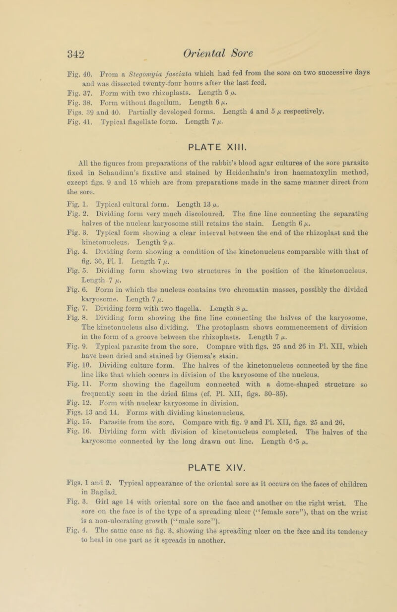 Fig. 40. From a Stegomyia fasciata which had fed from the sore on two successive days and was dissected twenty-four hours after the last feed. Fig. 37. Form with two rhizoplasts. Length 5 /x.. Fig. 38. Form without dagellum. Length 6 /x. Figs. 39 and 40. Partially developed forms. Length 4 and 5 ix respectively. Fig. 41. Typical flagellate form. Length 7 /x. PLATE XIII. All the figures from preparations of the rabbit’s blood agar cultures of the sore parasite fixed in Schaudinn’s fixative and stained by Heideuhain’s iron haeniatoxylin method, except figs. 9 and 15 which are from preparations made in the same manner direct from the sore. Fig. 1. Tj'pical cultural form. Length 13 /x. Fig. 2. Dividing form very much discoloured. The fine line connecting the separating halves of the nuclear karyosome still retains the stain. Length 6 fx. Fig. 3. Typical form showing a clear interval between the end of the rhizoplast and the kinetonucleus. Length 9 fx. Fig. 4. Dividing form showing a condition of the kinetonucleus comparable with that of fig. 36, PI. I. Length 7 /x. Fig. 5. Dividing form showing two structures in the position of the kinetonucleus. Length 7 /x. Fig. 6. Form in which the nucleus contains two chromatin masses, possibly the divided karyosome. Length 7 fx. Fig. 7. Dividing form with two flagella. Length 8 /x. Fig. 8. Dividing form showing the fine line connecting the halves of the karymsome. The kinetonucleus also dividing. The protoplasm shows commencement of division in the form of a groove between the rhizoplasts. Length 7 /x. Fig. 9. Typical parasite from the sore. Compare with figs. 25 and 26 in PI. XII, which have been dried and stained by Giemsa’s stain. Fig. 10. Dividing culture form. The halves of the kinetonucleus connected by the fine line like that which occurs in division of the karyosome of the nucleus. Fig. 11. Form showing the flagellum connected with a dome-shaped structure so frequently seen in the dried films (cf. PI. XII, figs. 30-35). Fig. 12. Form with nuclear karyosome in division. Figs. 13 and 14. Forms with dividing kinetonucleus. Fig. 15. Parasite from the sore. Compare with fig. 9 and PI. XII, figs. 25 and 26. Fig. 16. Dividing form with division of kinetonucleus completed. The halves of the karyosome connected by the long drawn out line. Length 6’5 fx. PLATE XIV. Figs. 1 and 2. Typical appearance of the oriental sore as it occurs on the faces of children in Bagdad. Fig. 3. Girl age 14 with oriental sore on the face and another on the right wrist. The sore on the face is of the type of a spreading ulcer (“female sore”), that on the wrist is a non-ulcerating growth (“male sore”). Fig. 4. The same case as fig. 3, showing the spreading ulcer on the face and its tendency to heal in one part as it spreads in another.