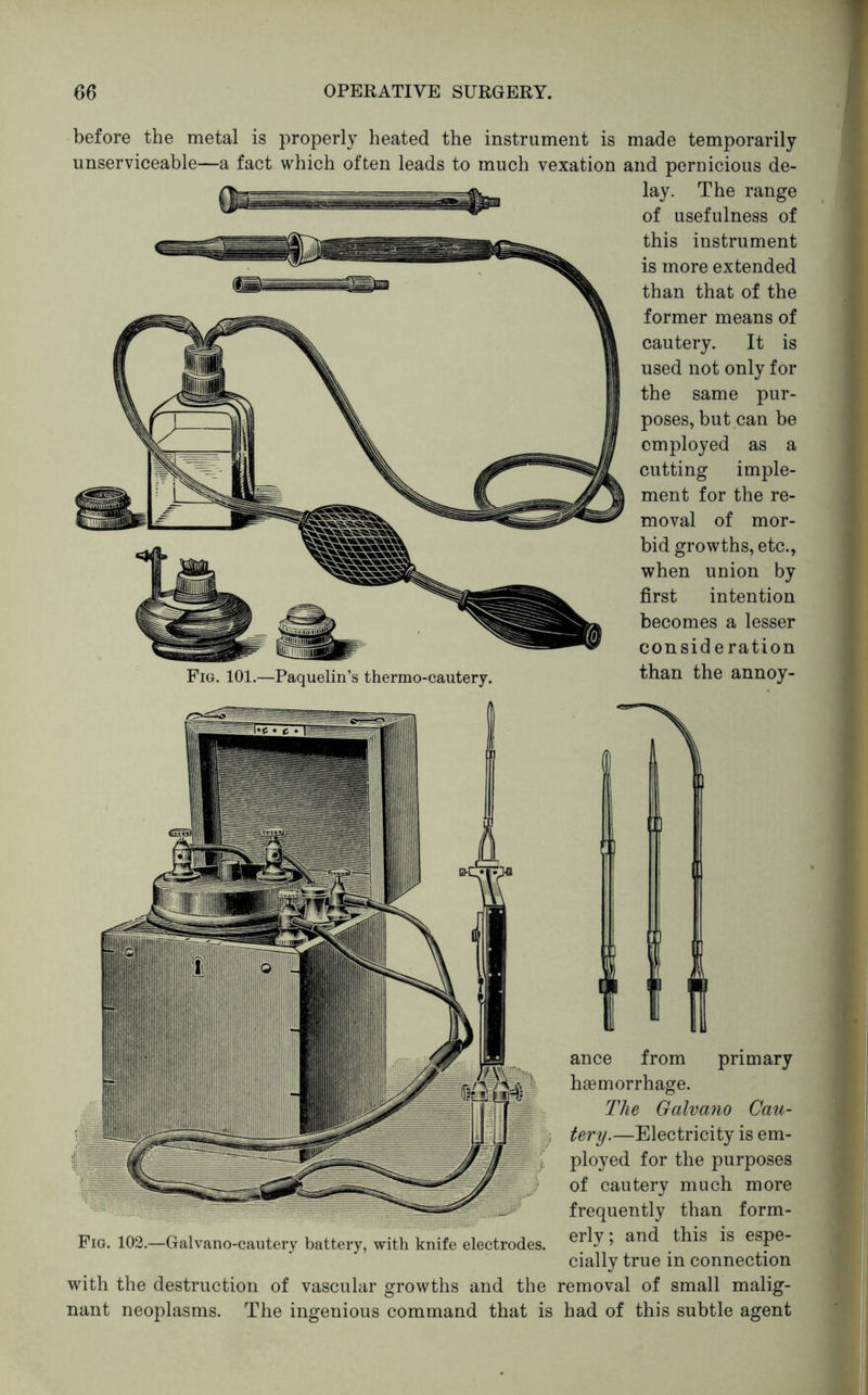 before the metal is properly heated the instrument is made temporarily unserviceable—a fact which often leads to much vexation and pernicious de- lay. The range of usefulness of this instrument is more extended than that of the former means of cautery. It is used not only for the same pur- poses, but can be employed as a cutting imjDle- ment for the re- moval of mor- bid growths, etc., when union by first intention becomes a lesser consideration Fig. 101.—Paquelin’s thermo-cautery. than the annoy- Fig. 102.—Galvano-cautery battery, with knife electrodes. ance from primary haemorrhage. The Galvano Cau- tery.—Electricity is em- ployed for the purposes of cautery much more frequently than form- erly ; and this is espe- cially true in connection with the destruction of vascular growths and the removal of small malig- nant neoplasms. The ingenious command that is had of this subtle agent