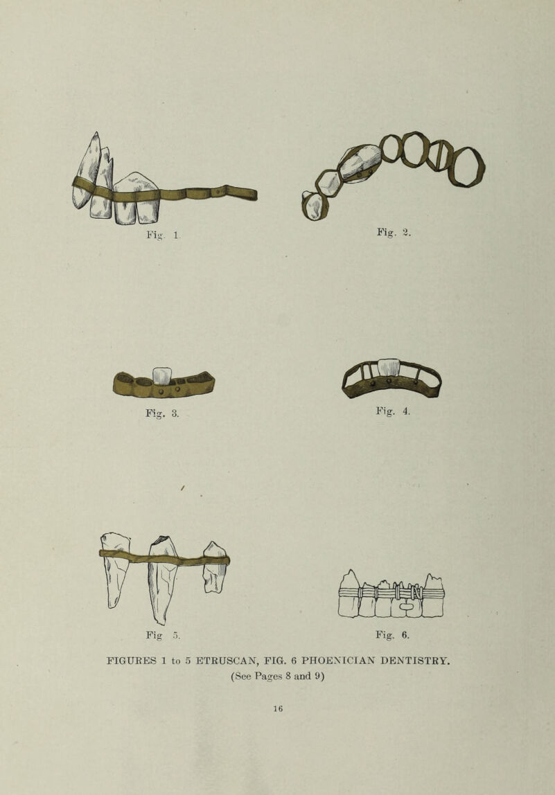 FIGURES 1 to 5 ETRUSCAN, FIG. 6 PHOENICIAN DENTISTRY. (See Pages 8 and 9)