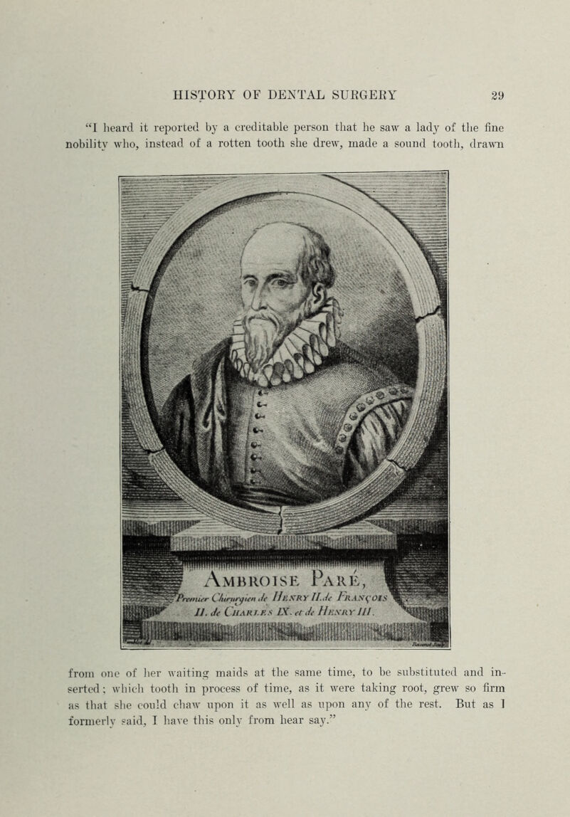 “I heard it reported by a creditable person that he saw a lady of the fine nobility who, instead of a rotten tooth she drew, made a sound tooth, drawn w Ambrgise Pare, \ Prvmitr (J/nniryttn Jt IIeXRY II.Jt I'HAS^'OIS 11. Jt ( HAH I K S IX. tt Jt HKXAY 111. from one of lier waiting maids at the same time, to be substituted and in- serted; which tooth in process of time, as it were taking root, grew so firm as that she could chaw upon it as well as upon any of the rest. But as 1 formerly said, I have this only from hear say.”