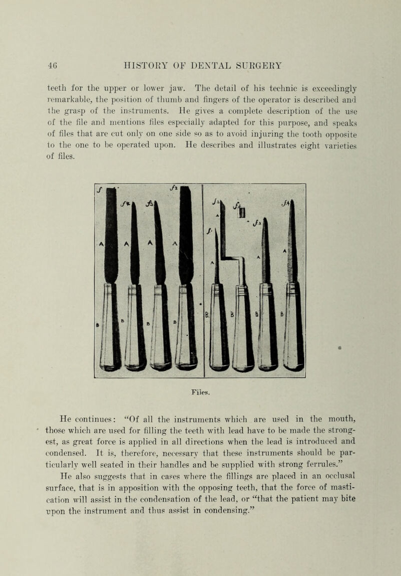 teeth for the upper or lower jaw. The detail of his technic is exceedingly remarkable, the position of thumb and fingers of the operator is described and the grasp of the instruments. lie gives a complete description of the use of the tile and mentions tiles especially adapted for this purpose, and speaks of tiles that are cut only on one side so as to avoid injuring the tooth opposite to the one to be operated upon. He describes and illustrates eight varieties of files. Files. He continues: “Of all the instruments which are used in the mouth, those which are used for filling the teeth with lead have to be made the strong- est, as great force is applied in all directions when the lead is introduced and condensed. It is, therefore, necessary that these instruments should be par- ticularly well seated in their handles and be supplied with strong ferrules.” He also siiggests that in cases where the fillings are placed in an occlusal surface, that is in apposition with the opposing teeth, that the force of masti- cation will assist in the condensation of the lead, or “that the patient may bite upon the instrument and thus assist in condensing.”