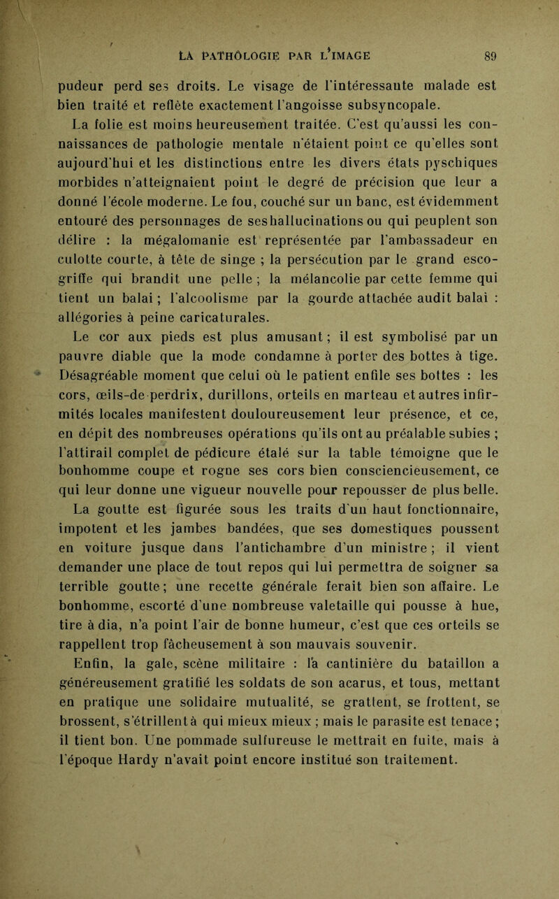 pudeur perd ses droits. Le visage de Tintéressaute malade est bien traité et reflète exactement l’angoisse subsyncopale. La folie est moins heureusement traitée. C’est qu’aussi les con- naissances de pathologie mentale n'étaient point ce qu’elles sont aujourd’hui et les distinctions entre les divers états pyschiques morbides n’atteignaient point le degré de précision que leur a donné l’école moderne. Le fou, couché sur un banc, est évidemment entouré des personnages de seshallucinations ou qui peuplent son délire : la mégalomanie est représentée par l’ambassadeur en culotte courte, à tête de singe ; la persécution par le grand esco- griffe qui brandit une pelle ; la mélancolie par cette femme qui tient un balai ; l’alcoolisme par la gourde attachée audit balai : allégories à peine caricaturales. Le cor aux pieds est plus amusant ; il est symbolisé par un pauvre diable que la mode condamne à porter des bottes à tige. Désagréable moment que celui où le patient enfile ses bottes : les cors, œils-de perdrix, durillons, orteils en marteau et autres infir- mités locales manifestent douloureusement leur présence, et ce, en dépit des nombreuses opérations qu’ils ont au préalable subies ; l’attirail complet de pédicure étalé sur la table témoigne que le bonhomme coupe et rogne ses cors bien consciencieusement, ce qui leur donne une vigueur nouvelle pour repousser de plus belle. La goutte est figurée sous les traits d’un haut fonctionnaire, impotent et les jambes bandées, que ses domestiques poussent en voiture jusque dans l’antichambre d’un ministre ; il vient demander une place de tout repos qui lui permettra de soigner sa terrible goutte; une recette générale ferait bien son affaire. Le bonhomme, escorté d’une nombreuse valetaille qui pousse à hue, tire à dia, n’a point l’air de bonne humeur, c’est que ces orteils se rappellent trop fâcheusement à son mauvais souvenir. Enfin, la gale, scène militaire : la cantinière du bataillon a généreusement gratifié les soldats de son acarus, et tous, mettant en pratique une solidaire mutualité, se grattent, se frottent, se brossent, s’étrillent à qui mieux mieux ; mais le parasite est tenace ; il tient bon. Une pommade sulfureuse le mettrait en fuite, mais à l’époque Hardy n’avait point encore institué son traitement.