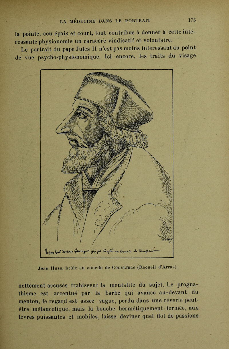 la pointe, cou épais et court, tout contribue à donner à cette inté- ressante physionomie un caracère vindicatif et volontaire. Le portrait du pape Jules II n’est pas moins intéressant au point de vue psycho-physionomique. Ici encore, les traits du visage nettement accusés trahissent la mentalité du sujet. Le progna- thisme est accentué par la barbe qui avance au-devant du menton, le regard est assez vague, perdu dans une rêverie peut- être mélancolique, mais la bouche hermétiquement fermée, aux lèvros puissantes et mobiles, laisse deviner quel flot de passions