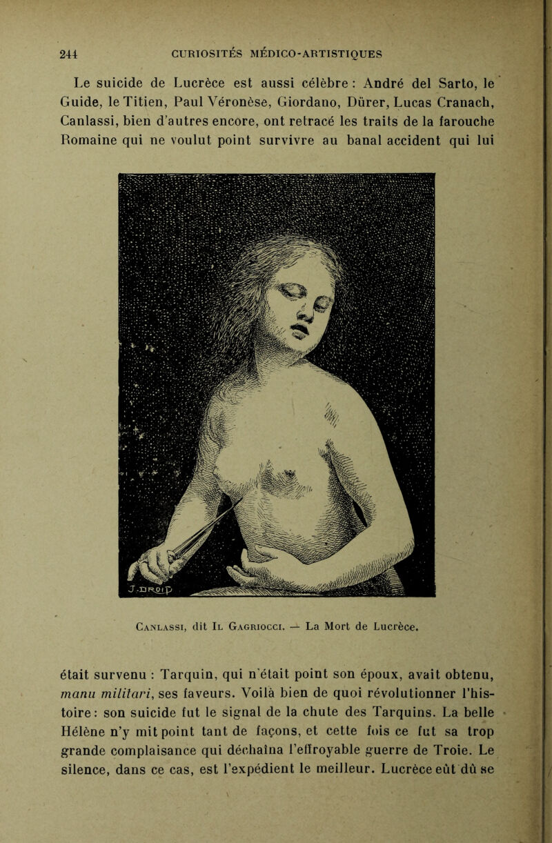 Le suicide de Lucrèce est aussi célèbre : André del Sarto, le Guide, le Titien, Paul Véronèse, Giordano, Dürer, Lucas Cranach, Canlassi, bien d’autres encore, ont retracé les traits de la farouche Romaine qui ne voulut point survivre au banal accident qui lui Canlassi, dit II Gagriocci. — La Mort de Lucrèce. était survenu : Tarquin, qui n’était point son époux, avait obtenu, manu militari, ses faveurs. Voilà bien de quoi révolutionner l’his- toire: son suicide fut le signal de la chute des Tarquins. La belle Hélène n’y mit point tant de façons, et cette fois ce fut sa trop grande complaisance qui déchaîna l’efïroyable guerre de Troie. Le silence, dans ce cas, est l’expédient le meilleur. Lucrèce eût dû se