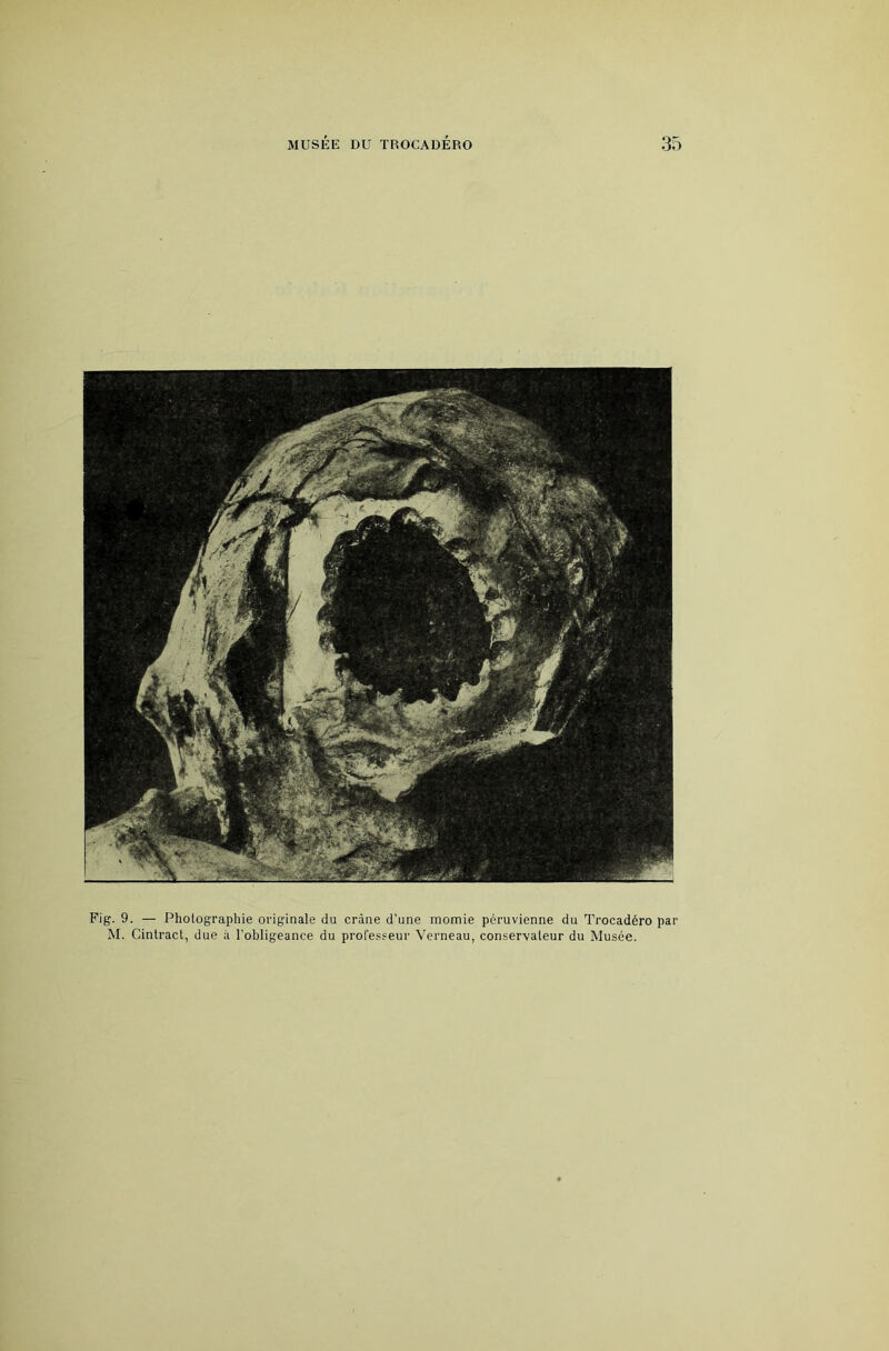 Fig. 9. — Photographie originale du crâne d'une momie péruvienne du Trocadéro par M. Cintract, due à l’ohligeance du professeur Verneau, conservateur du Musée.