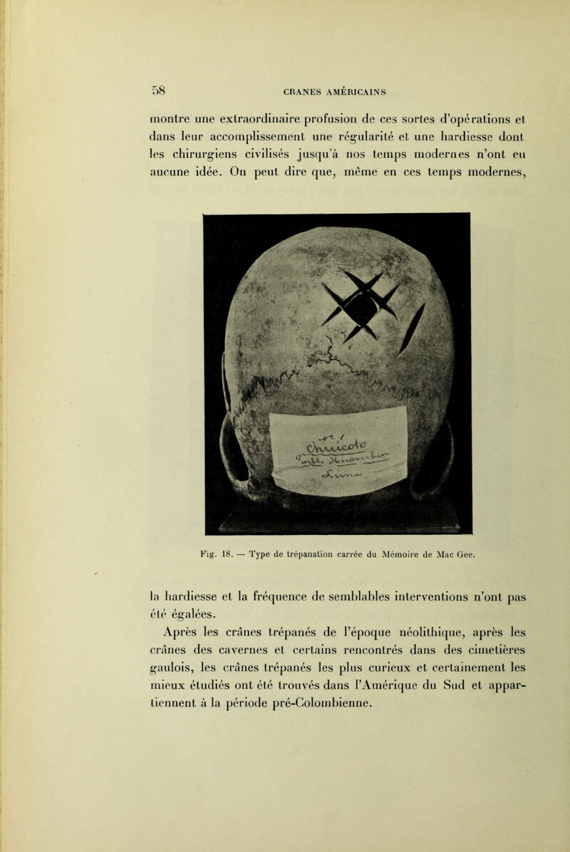 montre une extraordinaire profusion de ces sortes d’opérations et dans leur accomplissement une régularité et une hardiesse dont les chirurgiens civilisés jusqu’à nos temps modernes n’ont eu aucune idée. On peut dire que, même en ces temps modernes, Fig. 18. — Type de trépanation carrée du Mémoire de Mac Gee. la hardiesse et la fréquence de semblables interventions n’ont pas été égalées. Après les crânes trépanés de l’époque néolithique, après les crânes des cavernes et certains rencontrés dans des cimetières gaulois, les crânes trépanés les plus curieux et certainement les mieux étudiés ont été trouvés dans l’Amérique du Sud et appar- tiennent à la période pré-Colombienne.