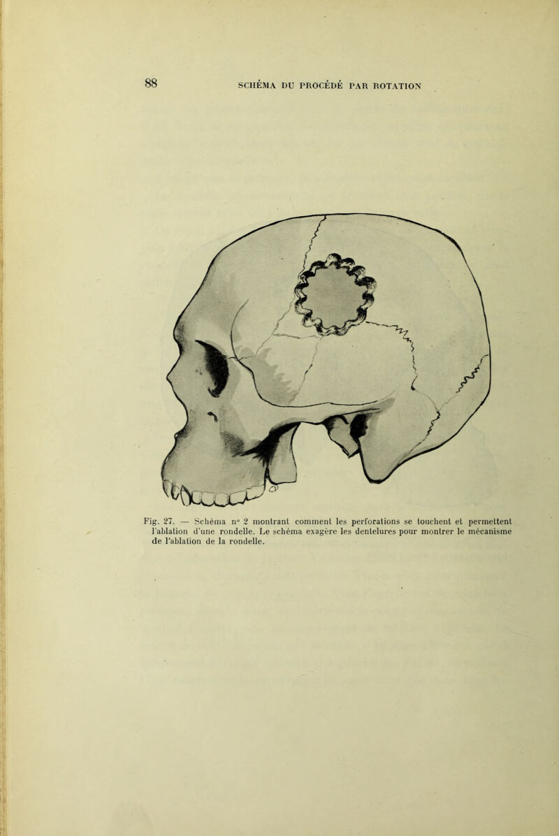 SCHÉMA DU PROCÉDÉ PAR ROTATION Fig. 27. — Schéma n“ 2 montrant comment les perforations se touchent et permettent l'ablation d’une rondelle. Le schéma exagère les dentelures pour montrer le mécanisme de l'ablation de la rondelle.