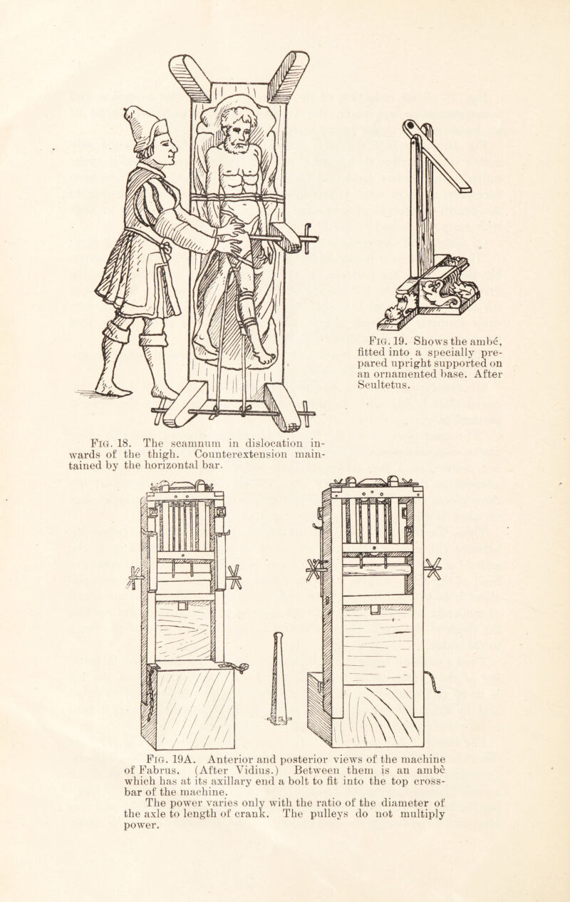 fitted into a specially pre- pared upright supported on an ornamented base. After Scultetus. Fig. 18. The scamnum in dislocation in- wards of the thigh. Counterextension main- tained by the horizontal bar. Fig. 19A. Anterior and posterior views of the machine of Fabrus. (After Vidius.) Between them is an ambe which has at its axillary end a bolt to fit into the top cross- bar of the machine. The power varies only with the ratio of the diameter of the axle to length of crank. The pulleys do not multiply power.