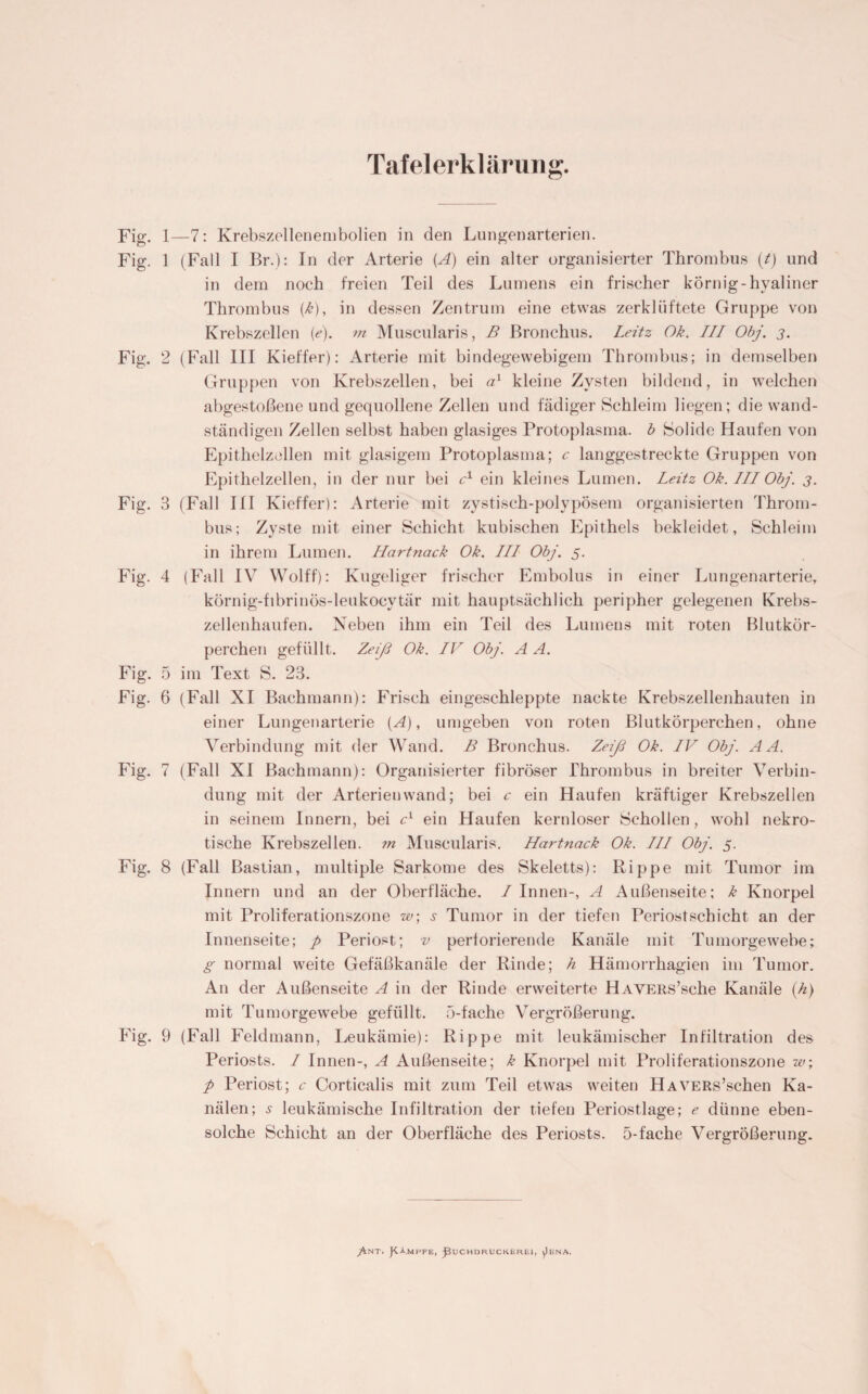 Tafelerklärung. Fig. 1—7: Krebszellenembolien in den Lungenarterien. Fig. 1 (Fall I Br.): In der Arterie (A) ein alter organisierter Thrombus (t) und in dem noch freien Teil des Lumens ein frischer körnig-hyaliner Thrombus {k), in dessen Zentrum eine etwas zerklüftete Gruppe von Krebszellen (<?). m Muscularis, B Bronchus. Leitz Ok. III Obj. 3. Fig. 2 (Fall III Kieffer): Arterie mit bindegewebigem Thrombus; in demselben Gruppen von Krebszellen, bei a1 kleine Zysten bildend, in welchen abgestoßene und gequollene Zellen und fädiger Schleim liegen; die wand¬ ständigen Zellen selbst haben glasiges Protoplasma, b Solide Haufen von Epithelzellen mit glasigem Protoplasma; c langgestreckte Gruppen von Epithelzellen, in der nur bei c1 ein kleines Lumen. Leitz Ok. III Obj. 3. Fig. 3 (Fall III Kieffer): Arterie mit zystisch-polypösem organisierten Throm¬ bus; Zyste mit einer Schicht kubischen Epithels bekleidet, Schleim in ihrem Lumen. Hartnack Ok. III Obj. 5. Fig. 4 (Fall IV Wolff): Kugeliger frischer Embolus in einer Lungenarterie, körnig-fibrinös-leukocytär mit hauptsächlich peripher gelegenen Krebs¬ zellenhaufen. Neben ihm ein Teil des Lumens mit roten Blutkör¬ perchen gefüllt. Zeiß Ok. IV Obj. A A. Fig. 5 im Text S. 23. Fig. 6 (Fall XI Bachmann): Frisch eingeschleppte nackte Krebszellenhauten in einer Lungenarterie (A), umgeben von roten Blutkörperchen, ohne Verbindung mit der Wand. B Bronchus. Zeiß Ok. IV Obj. A A. Fig. 7 (Fall XI Bachmann): Organisierter fibröser Thrombus in breiter Verbin¬ dung mit der Arterien wand; bei c ein Haufen kräftiger Krebszellen in seinem Innern, bei c1 ein Haufen kernloser Schollen, wohl nekro¬ tische Krebszellen, m Muscularis. Hartnack Ok. III Obj. 5. Fig. 8 (Fall Bastian, multiple Sarkome des Skeletts): Rippe mit Tumor im Innern und an der Oberfläche. I Innen-, A Außenseite; k Knorpel mit Proliferationszone w; s Tumor in der tiefen Periostschicht an der Innenseite; p Periost; v perforierende Kanäle mit Tumorgewebe; g normal weite Gefäßkanäle der Rinde; h Hämorrhagien im Tumor. An der Außenseite A in der Rinde erweiterte HAVERs’sche Kanäle (h) mit Tumorgewebe gefüllt. 5-fache Vergrößerung. Fig. 9 (Fall Feldmann, Leukämie): Rippe mit leukämischer Infiltration des Periosts. / Innen-, A Außenseite; k Knorpel mit Proliferationszone w; p Periost; c Corticalis mit zum Teil etwas weiten HAVERs’schen Ka¬ nälen; ^ leukämische Infiltration der tiefen Periostlage; e dünne eben¬ solche Schicht an der Oberfläche des Periosts. 5-fache Vergrößerung. ^NT, JtÄ.MPFE, jäuCHDRUCKEREI, ^ENA.