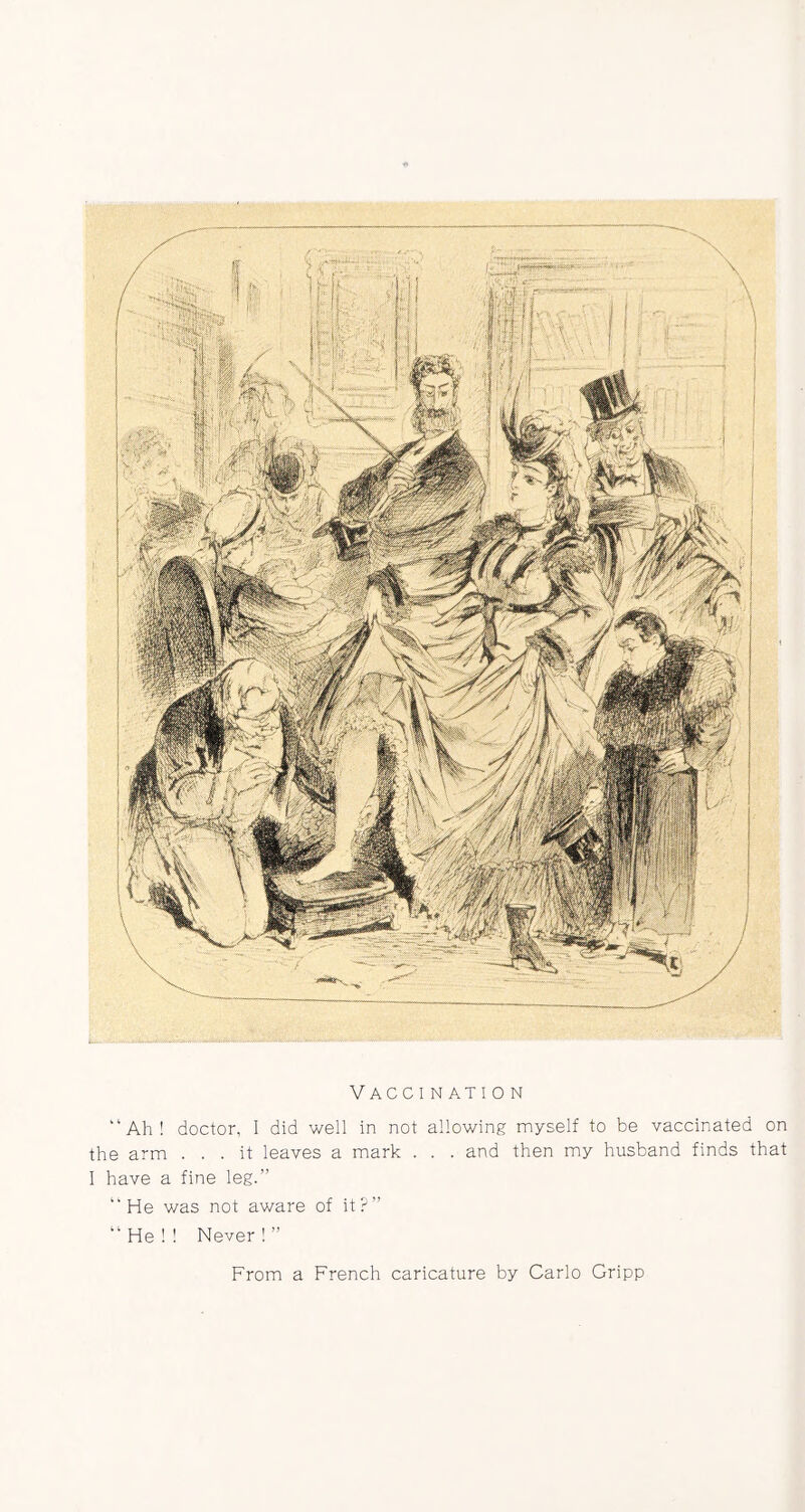 Vaccination “Ah! doctor, I did well in not allowing myself to be vaccinated on the arm ... it leaves a mark . . . and then my husband finds that I have a fine leg.” “He was not aware of it?” “He!! Never!” From a French caricature by Carlo Gripp