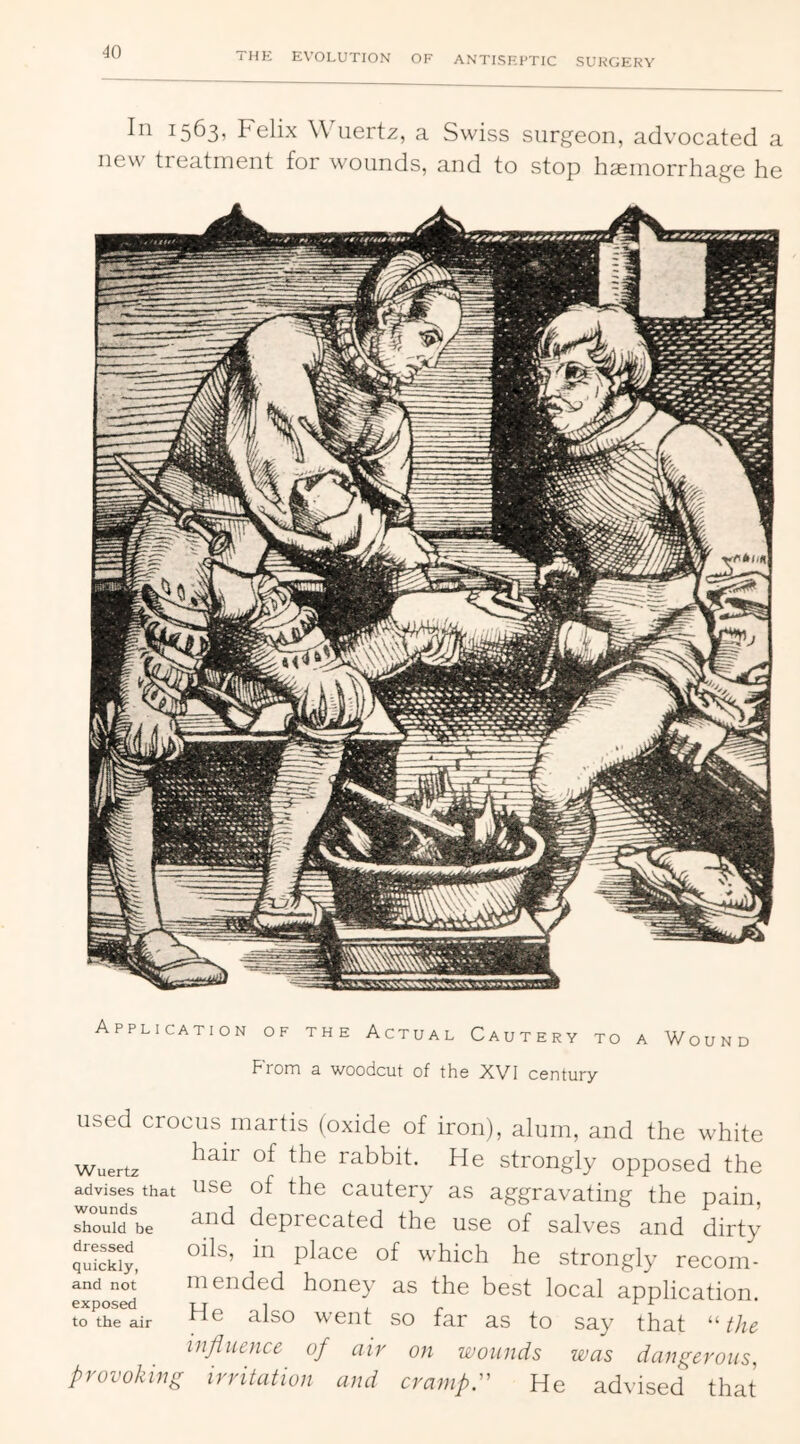 1563? telix Wiiertx, a Swiss surgeon, advocated a new treatment for wounds, and to stop hasinorrhage he Application of the Actual Cautery to a Wound From a woodcut of the XVI century used crocus inartis (oxide of iron), alum, and the white Wuertz rabbit. He strongly opposed the advises that ^isc of the cautcry as aggravating the pain, should be S-iid dcprccatcd the use of salves and dirty ZTckt, he strongly recom- and not mended honey as the best local application exposed 14 ^ } 1. r to the air 3-lso \v0nt SO lar cis to say that the influence of air on wounds was dangerous, provoking irritation and cramps He advised that