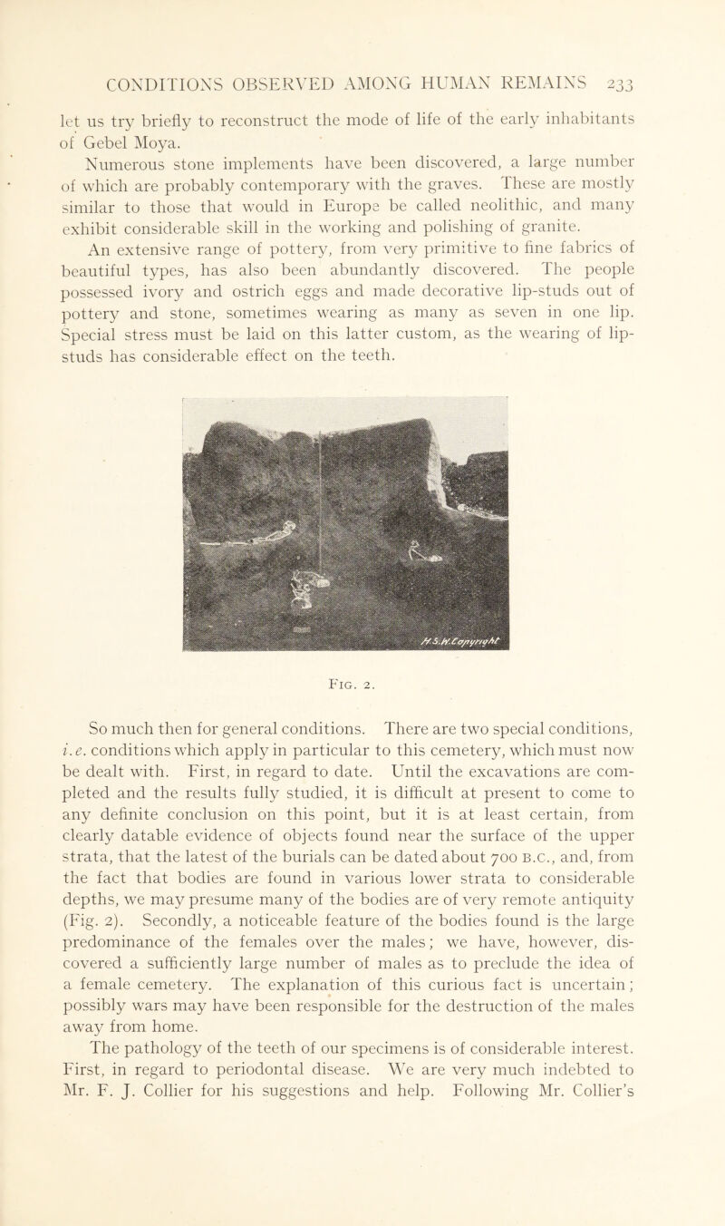 let us try briefly to reconstruct the mode of life of the early inhabitants of Gebel Moya. Numerous stone implements have been discovered, a large number of which are probably contemporary with the graves. These are mostly similar to those that would in Europe be called neolithic, and many exhibit considerable skill in the working and polishing of granite. An extensive range of pottery, from very primitive to flne fabrics of beautiful types, has also been abundantly discovered. The people possessed ivory and ostrich eggs and made decorative lip-studs out of pottery and stone, sometimes wearing as many as seven in one lip. Special stress must be laid on this latter custom, as the wearing of lip- studs has considerable effect on the teeth. Fig. 2. So much then for general conditions. There are two special conditions, i.e. conditions which apply in particular to this cemetery, which must now be dealt with. Eirst, in regard to date. Until the excavations are com- pleted and the results fully studied, it is difficult at present to come to any definite conclusion on this point, but it is at least certain, from clearly datable evidence of objects found near the surface of the upper strata, that the latest of the burials can be dated about 700 B.C., and, from the fact that bodies are found in various lower strata to considerable depths, we may presume many of the bodies are of very remote antiquity (Eig. 2). Secondly, a noticeable feature of the bodies found is the large predominance of the females over the males; we have, however, dis- covered a sufficiently large number of males as to preclude the idea of a female cemetery. The explanation of this curious fact is uncertain; possibly wars may have been responsible for the destruction of the males away from home. The pathology of the teeth of our specimens is of considerable interest. First, in regard to periodontal disease. We are very much indebted to Mr. F. J. Collier for his suggestions and help. Following Mr. Collier’s