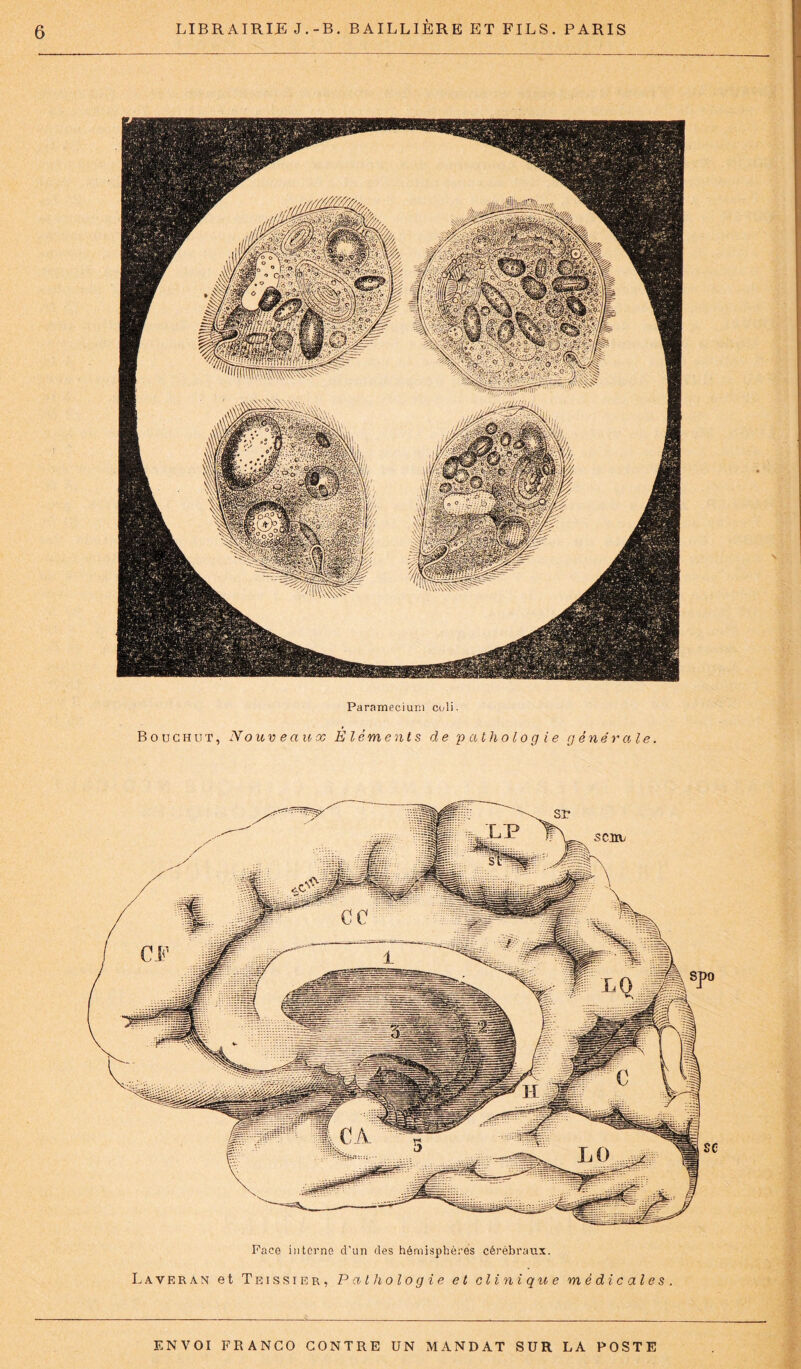 Paramecium coli. Bouchut, Nouveaux Eléments de pathologie générale. Face interne d'un des hémisphères cérébraux. Laveran et Teissier, Pathologie et cl i ni qu e médicales