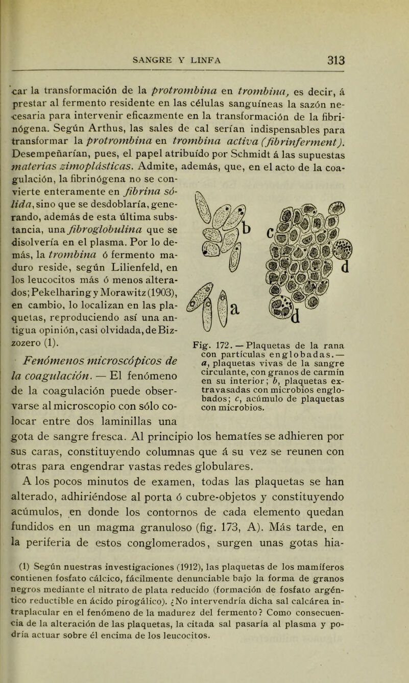 ‘car la transformación de la protrombina en tromhhia, es decir, á prestar al fermento residente en las células sanguíneas la sazón ne- cesaria para intervenir eficazmente en la transformación de la fibri- nógena. Según Arthus, las sales de cal serían indispensables para transformar la protrombina en trombina activa (fibrinferment). Desempeñarían, pues, el papel atribuido por Schmidt á las supuestas , materias simo plásticas. Admite, además, que, en el acto de la coa- gulación, la fibrinógena no se con- vierte enteramente en fibrina só- lida,sino que se desdoblaría, gene- rando, además de esta última subs- tancia, una fibroglobulina que se disolvería en el plasma. Por lo de- más, la trombina ó fermento ma- duro reside, según Lilienfeld, en los leucocitos más ó menos altera- dos; Pekelharingy Morawitz (1903), en cambio, lo localizan en las pla- quetas, reproduciendo así una an- tigua opinión, casi olvidada,deBiz- i zozero (1). Fenómenos microscópicos de la coagulación. — El fenómeno de la coagulación puede obser- varse al microscopio con sólo co- locar entre dos laminillas una gota de sangre fresca. Al principio los hematíes se adhieren por I sus caras, constituyendo columnas que á su vez se reúnen con otras para engendrar vastas redes globulares. A los pocos minutos de examen, todas las plaquetas se han alterado, adhiriéndose al porta ó cubre-objetos y constituyendo acúmulos, en donde los contornos de cada elemento quedan fundidos en un magma granuloso (fig. 173, A). Más tarde, en la periferia de estos conglomerados, surgen unas gotas hia- (1) Según nuestras investigaciones (1912), las plaquetas de los mamíferos contienen fosfato cálcico, fácilmente denunciable bajo la forma de granos negros mediante el nitrato de plata reducido (formación de fosfato argén- tico reductible en ácido pirogálico). ¿No intervendría dicha sal calcárea in- traplacular en el fenómeno de la madurez del fermento? Como consecuen- cia de la alteración de las plaquetas, la citada sal pasaría al plasma y po- dría actuar sobre él encima de los leucocitos. Fig. 172.—Plaquetas de la rana con partículas englobadas.— a, plaquetas vivas de la sangre circulante, con granos de carmín en su interior; b, plaquetas ex- travasadas con microbios englo- bados; c, acíimulo de plaquetas con microbios.