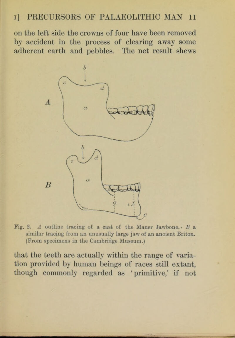 on the left side the crowns of four have been removed by accident in the process of clearing away some adherent earth and pebbles. The net result shews b Fig. 2. A outline tracing of a cast of the Mauer Jawbone.- B a similar tracing from an unusually large jaw of an ancient Briton. (From specimens in the Cambridge Museum.) that the teeth are actually within the range of varia- tion provided by human beings of races still extant, though commonly regarded as ‘primitive/ if not