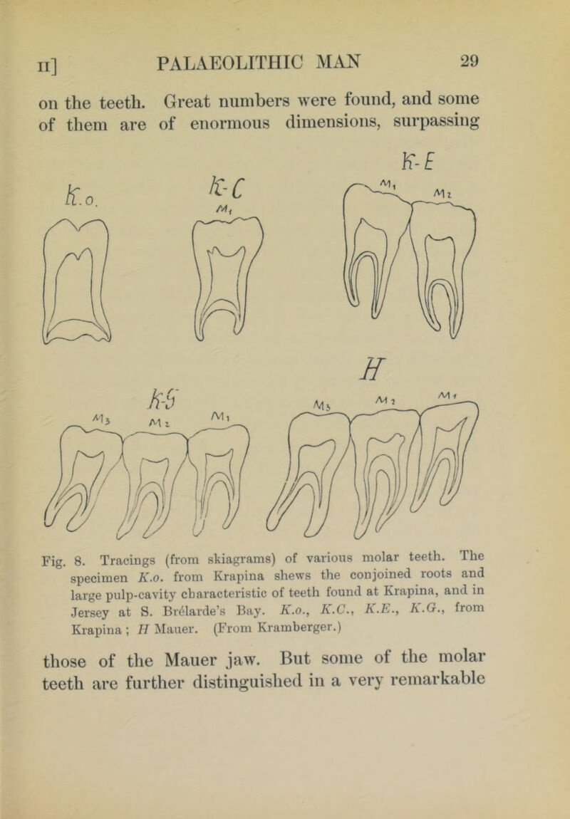 II] on the teeth. Great numbers were found, and some of tliem are of enormous dimensions, surpassing K-E Fig. 8. Tracings (from skiagrams) of various molar teeth. The specimen K.o. from Krapina shews the conjoined roots and large pulp-cavity characteristic of teeth found at Krapina, and in Jersey at S. Br^larde’s Bay. K.o., K.C., K.h., K.G., from Krapina ; H Mauer. (From Kramberger.) those of the Mauer jaw. But some of the molar teeth are further distinguished in a very remarkable