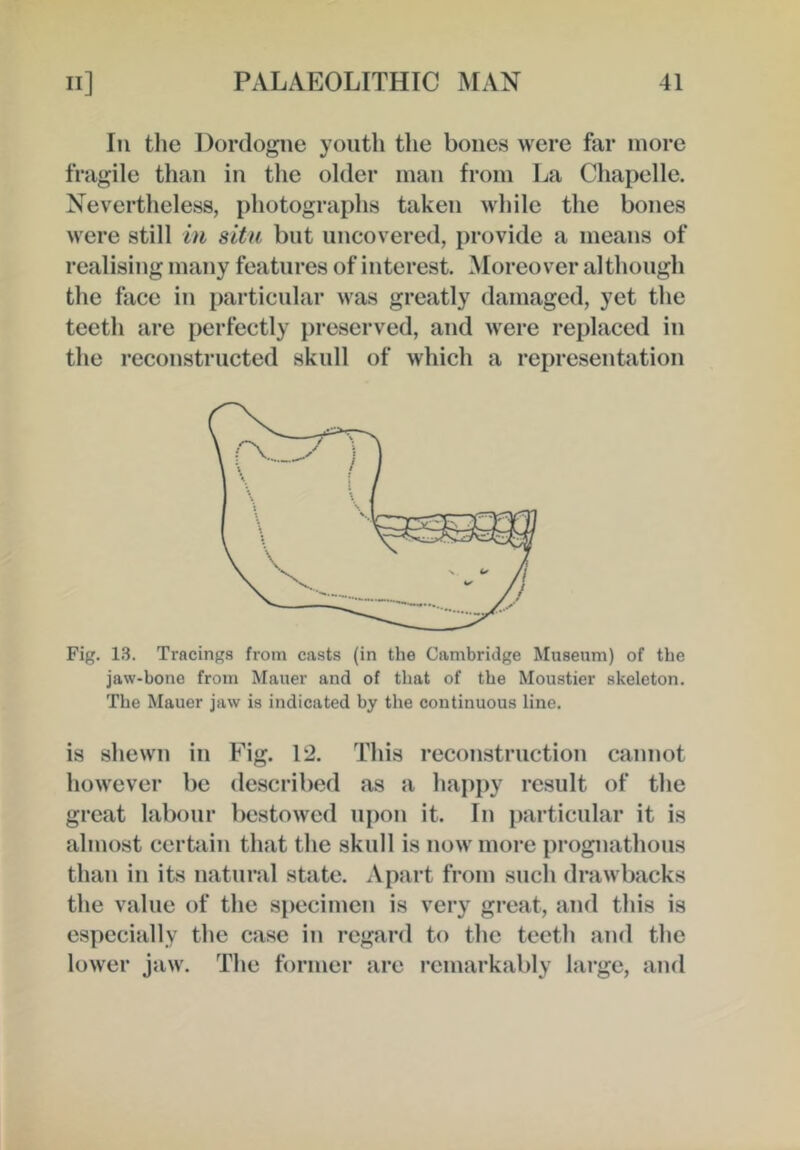 III tlie Dordogne youth the bones were far more fragile than in the older man from La Chapelle. Nevertheless, photographs taken while the bones were still hi situ but uncovered, provide a means of realising many features of interest. Moreover although the face in particular was greatly damaged, yet the teeth are perfectly preserved, and were replaced in the reconstructed skull of which a representation Fig. 13. Tracings from casts (in the Cambridge Museum) of the jaw-bone from Mauer and of that of the Moustier skeleton. The Mauer jaw is indicated by the continuous line. is shewn in Fig. l± This reconstruction cannot however be described as a happy result of the great labour bestowed upon it. In particular it is almost certain that the skull is now more prognathous than in its natural state. Apart from such drawbacks the value of the s[)ecimen is very great, and this is especially the case in regard to the teeth and the lower jaw. The former are remarkably large, and