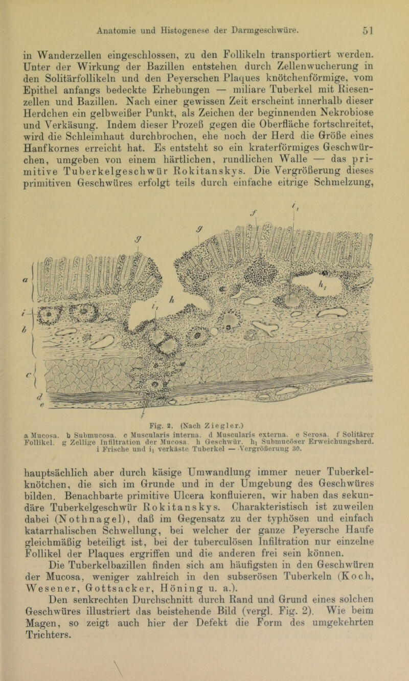 in Wanderzellen eingesclilossen, zu den Follikeln transportiert -werden. Unter der Wirkung der Bazillen entstehen durch Zellenwucherung in den Solitärfollikeln und den Peyerschen Plaques knötchenförmige, vom Epithel anfangs bedeckte Erhebungen — miliare Tuberkel mit Kiesen- zellen und Bazillen. Nach einer gewissen Zeit erscheint innerhalb dieser Herdchen ein gelbweißer Punkt, als Zeichen der beginnenden Nekrobiose und Verkäsung. Indem dieser Prozeß gegen die Oberfläche fortschreitet, wird die Schleimhaut durchbrochen, ehe noch der Herd die Größe eines Hanfkornes erreicht hat. Es entsteht so ein kraterförmiges Geschwür- chen, umgeben von einem härtlichen, rundlichen Walle — das pri- mitive Tuberkelgeschwür Rokitanskys. Die Vergrößerung dieses primitiven Geschwüres erfolgt teils durch einfache eitrige Schmelzung, Fig. 2. (Nach Ziegler.) a Mucosa. b Submucosa. c Muscularis interna, il Muscularis externa, e Serosa. f Solitärer Follikel, g Zellige Infiltration der .Mucosa. h Geschwür, hi Submucöser Erweichungsherd, i Frische und i] verkäste Tuberkel —Vergrößerung 30. hauptsächlich aber durch käsige Umwandlung immer neuer Tuberkel- knötchen, die sich im Grunde und in der Umgebung des Geschwüres bilden. Benachbarte primitive Ulcera konfluieren, wir haben das sekun- däre Tuberkelgeschwür Rokitanskys. Charakteristisch ist zuweilen dabei (Nothnagel), daß im Gegensatz zu der typhösen und einfach katarrhalischen Schwellung, bei welcher der ganze Peyersche Haufe gleichmäßig beteiligt ist, bei der tuberculösen Infiltration nur einzelne Follikel der Plaques ergriffen und die anderen frei sein können. Die Tuberkelbazillen finden sich am häufigsten in den Geschwüren der Mucosa, weniger zahlreich in den subserösen Tuberkeln (Koch, Wesener, Gottsacker, Höning u. a.). Den senkrechten Durchschnitt durch Rand und Grund eines solchen Geschwüres illustriert das beistehende Bild (vergl. Fig. 2). Wie beim Magen, so zeigt auch hier der Defekt die Form des umgekehrten Trichters.