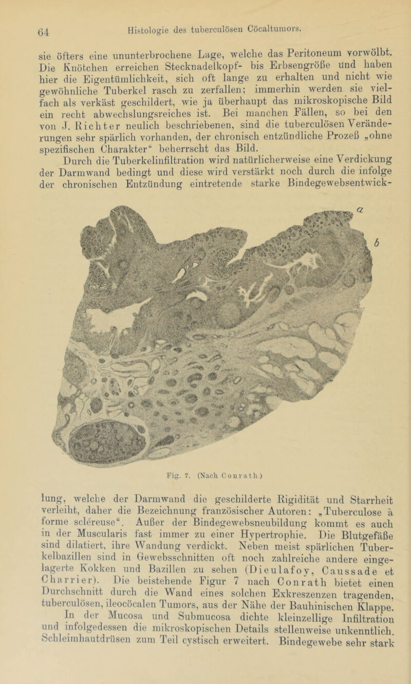 sie öfters eine ununterbrochene Lage, welche das Peritoneum voiwölbt. Die Knötchen erreichen Stecknadelkopf- bis Erbsengröße und haben hier die Eigentümlichkeit, sich oft lange zu erhalten und nicht wie gewöhnliche Tuberkel rasch zu zerfallen; immerhin werden sie viel- fach als verkäst geschildert, wie ja überhaupt das mikroskopische Bild ein ]'echt abwechslungsreiches ist. Bei manchen Fällen, so bei den von -1. Richter neulich beschriebenen, sind die tuberculösen Verände- rungen sehr spärlich vorhanden, der chronisch entzündliche Prozeß „ohne spezifischen Charakter*’ beherrscht das Bild. Durch die Tuberkelinfiltration wird natürlicherweise eine Verdickung der Darmwand bedingt und diese wird verstärkt noch durch die infolge der chronischen Entzündung eintretende starke Bindegewebsentwick- Fig. 7. (Nach Coinatli.) lung, welche der Darmwand die geschilderte Rigidität und Starrheit verleiht, daher die Bezeichnung französischer Autoren: „Tuberculose ä forme sclereuse“. Außer der Bindegewebsneubildung kommt es auch in der Muscularis fast immer zu einer Hypertrophie. Die Blutgefäße sind dilatiert, ihre Wandung verdickt. Neben meist spärlichen Tuber- kelbazillen sind in Gewebsschnitten oft noch zahlreiche andere eino'e- lagerte Kokken und Bazillen zu sehen (Dieulafoy, Caussade'^et Charrier). Die beistehende Figur 7 nach Conrath bietet einen Durchschnitt durch die Wand eines solchen Exkreszenzen tragenden, tuberculösen, ileocöcalen Tumors, aus der Nähe der Bauhinischen Klappe! In dei Mucosa und Submucosa dichte kleinzellige Infiltration und infolgedessen die mikroskopischen Details stellenweise unkenntlich. Schleimhautdrüsen zum Teil cystisch erweitert. Bindegewebe sehr stark