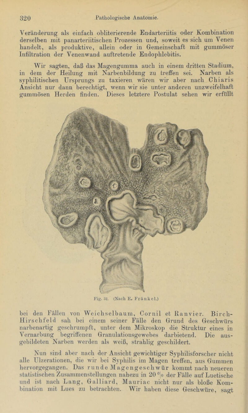Veränderung als einfach obliterierende Endarteriitis oder Kombination derselben mit panarteriitischen Prozessen und, soweit es sich um Venen handelt, als produktive, allein oder in Gemeinschaft mit gummöser Infiltration der Venenwand auftretende Endophlebitis. Wir sagten, daß das Magengumma auch in einem dritten Stadium, in dem der Heilung mit Narbenbildung zu treffen sei. Narben als syphilitischen Ursprungs zu taxieren wären wir aber nach Chiaris Ansicht nur dann berechtigt, wenn wir sie unter anderen unzweifelhaft gummösen Herden finden. Dieses letztere Postulat sehen wir erfüllt Fig. 31. (Nach E. Fräiikel.) bei den Fällen von Weichselbaum, Cornil et Ranvier. Birch- Hirschfeld sah bei einem seiner Fälle den Grund des Geschwürs narbenartig geschrumpft, unter dem Mikroskop die Struktur eines in Vernarbung begriöenen Granulationsgewebes darbietend. Die aus- gebildeten Narben werden als weiß, strahlig geschildert. Nun sind aber nach der Ansicht gewichtiger Syphilisforscher nicht alle Ulzerationen, die wir bei Syjihilis im Magen treffen, aus Gummen hervorgegangen. Das runde Magengeschwür kommt nach neueren statistischen Zusammenstellungen nahezu in 20 ^jo der Fälle auf Luetische und ist nach Lang, Galliard, Mauriac nicht nur als bloße Kom- bination mit Lues zu betrachten. Wir haben diese Geschwüre, sagt