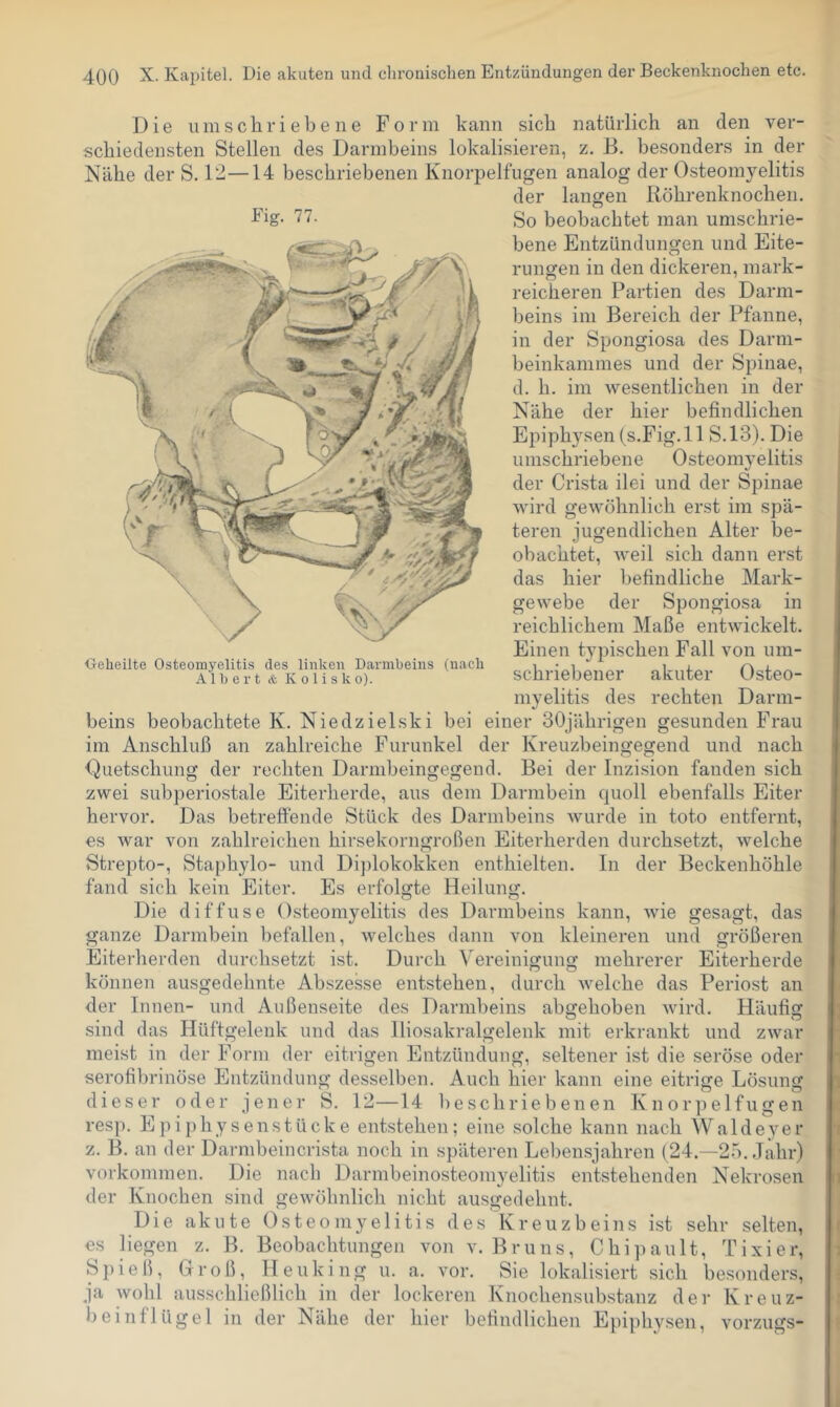 Die umschriebene Form kann sich natürlich an den ver- schiedensten Stellen des Darmbeins lokalisieren, z. B. besonders in der Nähe der S. 12—14 beschriebenen Knorpelfiigen analog der Osteomyelitis der langen Röhrenknochen. So beobachtet man umschrie- bene Entzündungen und Eite- rungen in den dickeren, mark- o ^ ’ reicheren Partien des Darm- beins im Bereich der Pfanne, in der Spongiosa des Darm- beinkammes und der Spinae, d. h. im wesentlichen in der Nähe der hier befindlichen Epiphysen (s.Fig. 11 S.13). Die umschriebene Osteomyelitis der Crista ilei und der Spinae wird gewöhnlich erst im spä- teren jugendlichen Alter be- obachtet, weil sich dann erst das hier befindliche Mark- gewebe der Spongiosa in reichlichem Maße entwickelt. Einen typischen Fall von um- schriebener akuter Osteo- myelitis des rechten Darm- beins beobachtete K. Niedzielski bei einer 30jährigen gesunden Frau im Anschluß an zahlreiche Furunkel der Kreuzbeingegend und nach Quetschung der rechten Darmbeingegend. Bei der Inzision fanden sich zwei subperiostale Eiterherde, aus dem Darmbein quoll ebenfalls Eiter hervor. Das betreffende Stück des Darmbeins wurde in toto entfernt, es war von zahlreichen hirsekorngroßen Eiterherden durchsetzt, welche Strepto-, Staphylo- und Diplokokken enthielten, ln der Beckenhöhle fand sich kein Eiter. Es erfolgte Heilung. Die diffuse Osteomyelitis des Darmbeins kann, wie gesagt, das ganze Darmbein befallen, welches dann von kleineren und größeren Eiterherden durchsetzt ist. Durch Vereinigung mehrerer Eiterherde können ausgedehnte Abszesse entstehen, durch welche das Periost an der Innen- und Außenseite des Darmbeins abgehoben wird. Häufig sind das Hüftgelenk und das lliosakralgelenk mit erkrankt und zwar meist in der Form der eitrigen Entzündung, seltener ist die seröse oder serofibrinöse Entzündung desselben. Auch hier kann eine eitrige Lösung dieser oder jener S. 12—14 beschriebenen Knorpelfugen resp. Epi physenstücke entstehen; eine solche kann nach AValdeyer z. B. an der Darmbeincrista noch in späteren Lebensjahren (24.—25. Jahr) Vorkommen. Die nach Darmbeinosteomyelitis entstehenden Nekrosen der Knochen sind gewöhnlich nicht ausgedehnt. Die akute Osteomyelitis des Kreuzbeins ist sehr selten, es liegen z. B. Beobachtungen von v. Bruns, Chipault, Fixier, Spieß, Groß, Heuking u. a. vor. Sie lokalisiert sich besonders, ja wohl ausschließlich in der lockeren Knochensub.stanz der Kreuz- beinflügel in der Nähe der hier befindlichen Epiphysen, vorzugs- Fig. 77. Oeheilte Osteomyelitis des linken Darmbeins (nacli Albert & K o 1 i s k o).