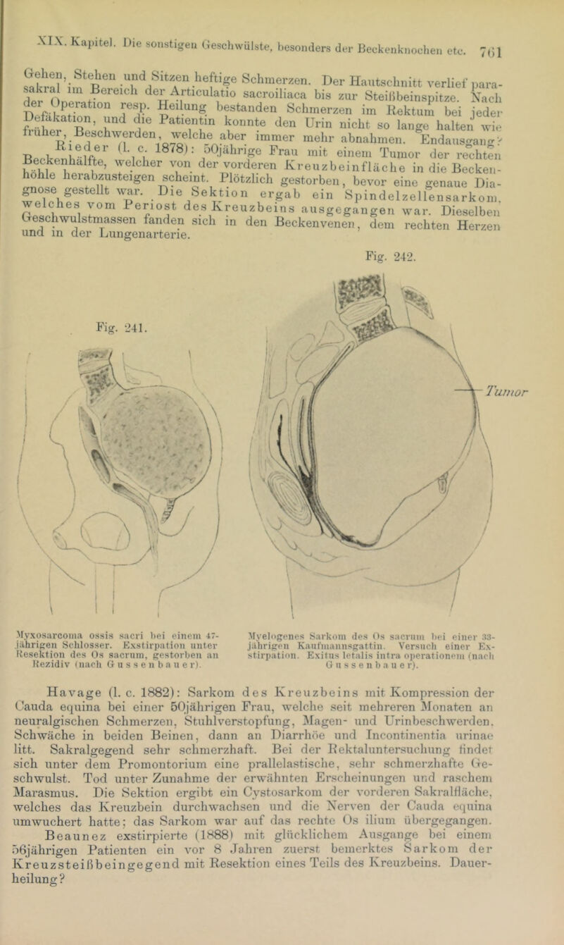 R®'' und Sitzen heftige Schmerzen. Der Hautschnitt verlief para- dpr ( np der Articulatio sacroiliaca bis zur Steihbeinspitze. Nach der Operation resp. Heilung bestanden Schmerzen im Kektum bei ieder Siulr Bp^cZp ^en Urin nicht so lange halten wie fiuher, Beschwerden welche aber immer mehr abnahmen. Endausgancrv Beck^hlfffp' einem Tumor der rechten Beckenhdlfte, welcher von der vorderen ivreuzbeinfläche in die Becken- hohle herabzusteigen scheint. Plötzlich gestorben, bevor eine genaue Dia- giose gestellt w^r. Die Sektion ergab ein Spindelzellensarkom. Ppjpi^^^i i^eriost des Kreuzbeins ausgegangen war. Dieselben Creschwulstmassen fanden sich in den Beckenvenen, dem rechten Herzen una in der Lungenarterie. Fig. 242. Fig. 241. My.xosarconia ossis sacri bei einem 47- .jahrigen Schlosser. Exstirpation unter Resektion des Os sacriim, gestorben an Rezidiv (nach G u s s e n b n u e r). Myelogenes Sarkom des Os sacviim bei einer .13- jilhrigen Kauf'mannsgattin. Versuch einer Ex- stirpation. Exitus letalis intra Operationen! (nach G u s s e n b a u e r). Havage (1. c. 1882): Sarkom des Kreuzbeins mit Kompression der Oauda equina bei einer öOjälirigen Frau, welche seit mehreren Monaten an neuralgischen Schmerzen, Stuhlverstopfung, Magen- und Urinbeschwerden. Schwäche in beiden Beinen, dann an Diarrhöe und Incontinentia urinae litt. Sakralgegend sehr schmerzhaft. Bei der Rektaluntersuchung lindet sich unter dem Promontorium eine prallelastische, sehr schmerzhafte (fe- sch wulst. Tod unter Zunahme der erwähnten Erscheinungen und raschem Marasmus. Die Sektion ergibt ein Cystosarkom der vorderen SakralHäche, welches das Kreuzbein durchwachsen und die Nerven der Cauda equina umwuchert hatte; das Sarkom war auf das rechte Os ilium übergegangen. Beaunez exstirpierte (1888) mit glücklichem Ausgange bei einem 06jährigen Patienten ein vor 8 Jahren zuerst bemerktes Sarkom der Kreuzsteißbeingegend mit Resektion eines Teils des Kreuzbeins. Dauer- heilung?