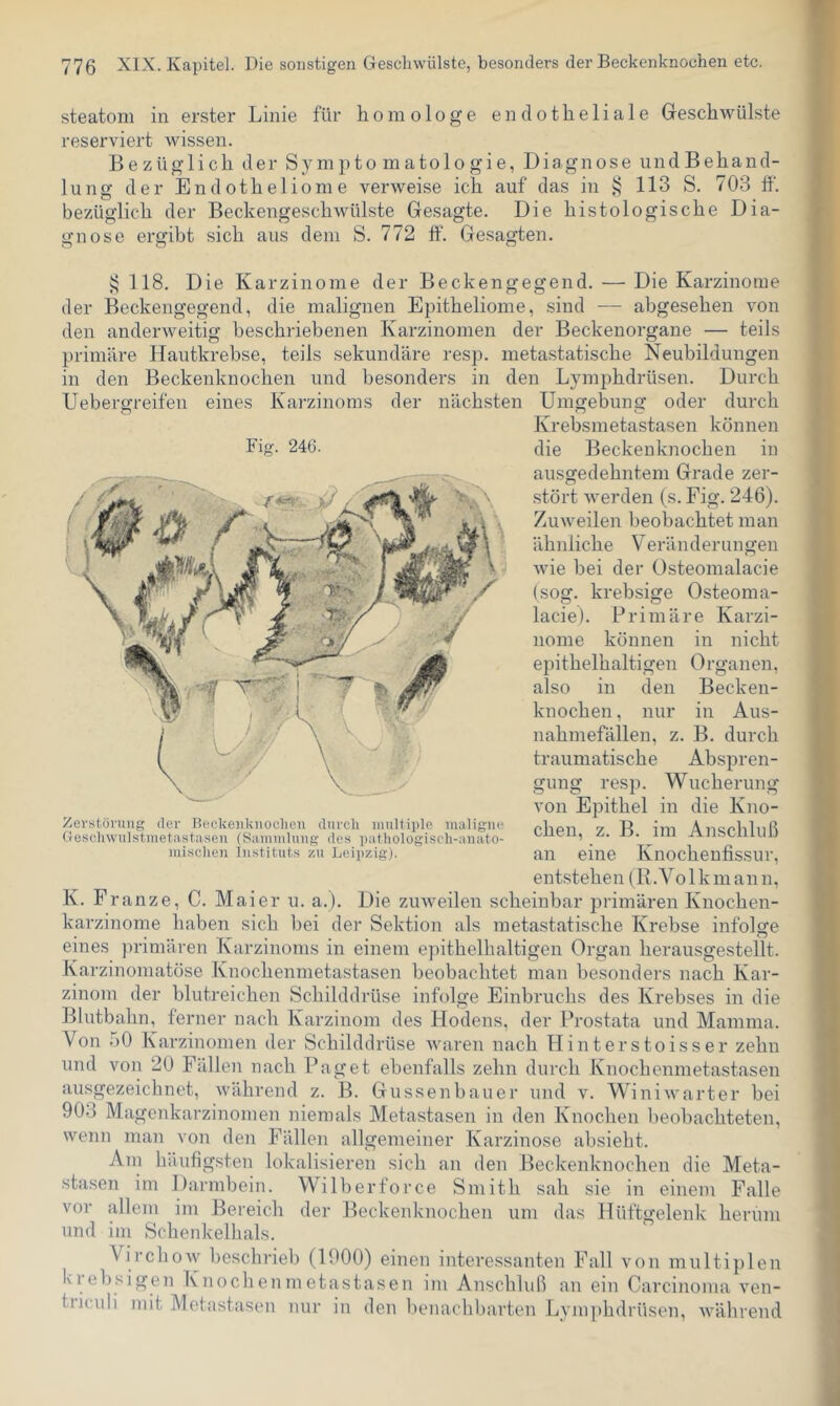 776 XIX. Kapitel. Die sonstigen Geschwülste, besonders der Beckenknochen etc. steatom in erster Linie für homologe endotheliale Geschwülste reserviert wissen. Bezüglich der Sympto matologie, Diagnose undBehand- lung der Endotheliome verweise ich auf das in 113 S. 703 ff. bezüglich der Beckengeschwülste Gesagte. Die histologische Dia- gnose ergibt sich aus dem S. 772 ff‘. Gesagten. i 118. Die Karzinome der Beckengegend. — Die Karzinome ; der Beckengegend, die malignen Epitheliome, sind — abgesehen von den anderweitig beschriebenen Karzinomen der Beckenorgane — teils primäre Hautkrebse, teils sekundäre resp. metastatische Neubildungen in den Beckenknochen und besonders in den Lymphdrüsen. Durch Uebergreifen eines Karzinoms der nächsten Umgebung oder durch Krebsmetastasen können die Beckenknochen in ausgedehntem Grade zer- .stört werden (s. Fig. 246). Zuweilen beobachtet man ähnliche Veränderungen Avie bei der Osteomalacie (sog. kreb.sige Osteoma- lacie). Primäre Karzi- nome können in nicht epithelhaltigen Organen, also in den Becken- knochen, nur in Aus- nahmefällen, z. B. durch traumatische Abspren- gung resp. Wucherung von Epithel in die Kno- chen, z. B. im Anschluß an eine Knochenfissur, entstehen (R.Volkmann, K. Franze, C. Maier u. a.). Die zuweilen scheinbar primären Knochen- karzinome haben sich bei der Sektion als metastatische Krebse infolsfe eines ])rimären Karzinoms in einem epithelhaltigen Organ herausgestellt. Karziiioniatöse Knochennietastasen beobachtet man besonders nach Kar- zinom der blutreichen Schilddrüse infolge Einbruchs des Krebses in die Blutbahn, ferner nach Karzinom des Hodens, der Prostata und Mamma. Von 50 Karzinomen der Schilddrüse waren nach Hinterstoisser zehn und von 20 Fällen nach Paget ebenfalls zehn durch Knochennietastasen ausgezeichnet, während z. B. Giissenbauer und v. Winiwarter bei 903 Magenkarzinonien niemals Metastasen in den Knochen beobachteten, wenn man von den Fällen allgemeiner Karzinose absieht. Am häiifig.sten lokalisieren sich an den Beckenknochen die Meta- stasen im Darmbein. Wilberforce Smith sah sie in einem Falle vor allem im Bereich der Beckenknochen um das Hüftgelenk herum und im Schenkelhals. Virchow beschrieb (1000) einen interessanten Fall von multiplen krebsigen Knochenmetastasen im Anschluß an ein Carcinoma ven- tiiculi mit Metastasen nur in den benachbarten Lymphdrüsen, Avährend Fig. 246. Zerstörung der Beckeiilviioclieii durch multiple maligne Oescliwulstmetastasen (Sammlung des ])athologi.scli-anato- mischen Instituts zu Leipzig).