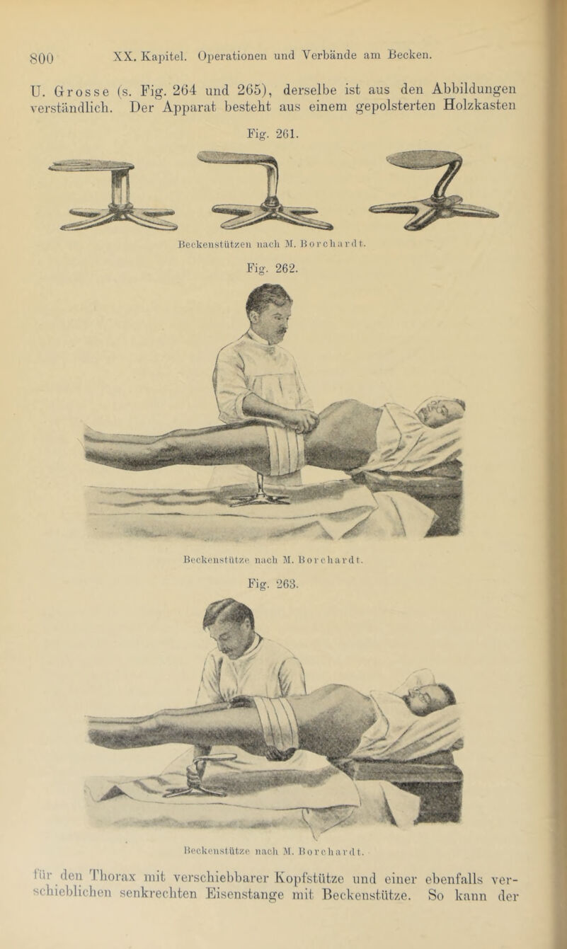 U. Grosse (s. Fig. 204 und 205), derselbe ist aus den Abbildungen verständlich. Der Apparat besteht aus einem gepolsterten Holzkasten Fig. 261. Fig. 262. neckenstütze nach M. norehavdt. Fig. 263. npckonstützo nacli .Al. Uorchardt. Hir (len Tliorax mit verschieltharcr lvo])l’stütze und einer ebenfalls ver- schieblichen senkrechten Eisenstange mit Beckenstütze. So kann der .i