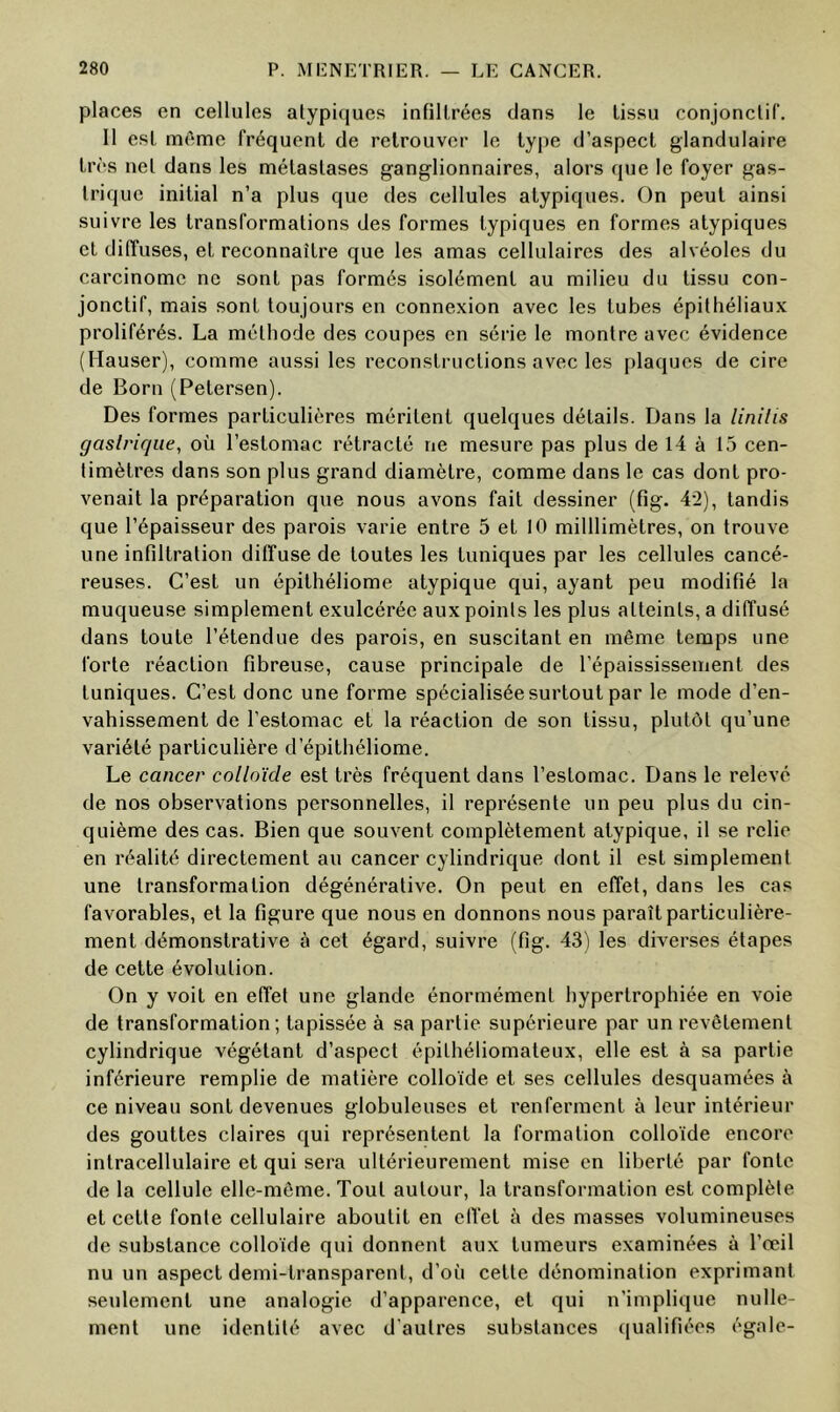 places en cellules atypiques infiltrées dans le tissu conjonctif. Il est même fréquent de retrouver le type d’aspect glandulaire très net dans les métastases ganglionnaires, alors que le foyer gas- trique initial n’a plus que des cellules atypiques. On peut ainsi suivre les transformations des formes typiques en formes atypiques et diffuses, et reconnaître que les amas cellulaires des alvéoles du carcinome ne sont pas formés isolément au milieu du tissu con- jonctif, mais sont toujours en connexion avec les tubes épithéliaux proliférés. La méthode des coupes en série le montre avec évidence (Hauser), comme aussi les reconstructions avec les plaques de cire de Boni (Petersen). Des formes particulières méritent quelques détails. Dans la linilis gaslrir/ue, où l’estomac rétracté ne mesure pas plus de 14 à 15 cen- timètres dans son plus grand diamètre, comme dans le cas dont pro- venait la préparation que nous avons fait dessiner (fig. 42), tandis que l’épaisseur des parois varie entre 5 et 10 milllimètres, on trouve une infiltration diffuse de toutes les tuniques par les cellules cancé- reuses. C’est un épithéliome atypique qui, ayant peu modifié la muqueuse simplement exulcérée aux points les plus atteints, a diffusé dans toute l’étendue des parois, en suscitant en même temps une forte réaction fibreuse, cause principale de l’épaississement des tuniques. C’est donc une forme spécialisée surtout par le mode d’en- vahissement de l’estomac et la réaction de son tissu, plutôt qu’une variété particulière d’épilhéliome. Le cancer colloïde est très fréquent dans l’estomac. Dans le relevé de nos observations personnelles, il représente un peu plus du cin- quième des cas. Bien que souvent complètement atypique, il se relie en réalité directement au cancer cylindrique dont il est simplement une transformation dégénérative. On peut en effet, dans les cas favorables, et la figure que nous en donnons nous paraît particulière- ment démonstrative à cet égard, suivre (fig. 43) les diverses étapes de cette évolution. On y voit en effet une glande énormément hypertrophiée en voie de transformation; tapissée à sa partie supérieure par un revêtement cylindrique végétant d’aspect épithéliomateux, elle est à sa partie inférieure remplie de matière colloïde et ses cellules desquamées à ce niveau sont devenues globuleuses et renferment à leur intérieur des gouttes claires qui représentent la formation colloïde encore intracellulaire et qui sera ultérieurement mise en liberté par fonte de la cellule elle-même. Tout autour, la transformation est complète et cette fonte cellulaire aboutit en clfet à des masses volumineuses de substance colloïde qui donnent aux tumeurs examinées à l’œil nu un aspect demi-transparent, d’où celte dénomination exprimant seulement une analogie d’apparence, et qui n’implique nulle- ment une identité avec d'autres substances (|ualifiées égale-