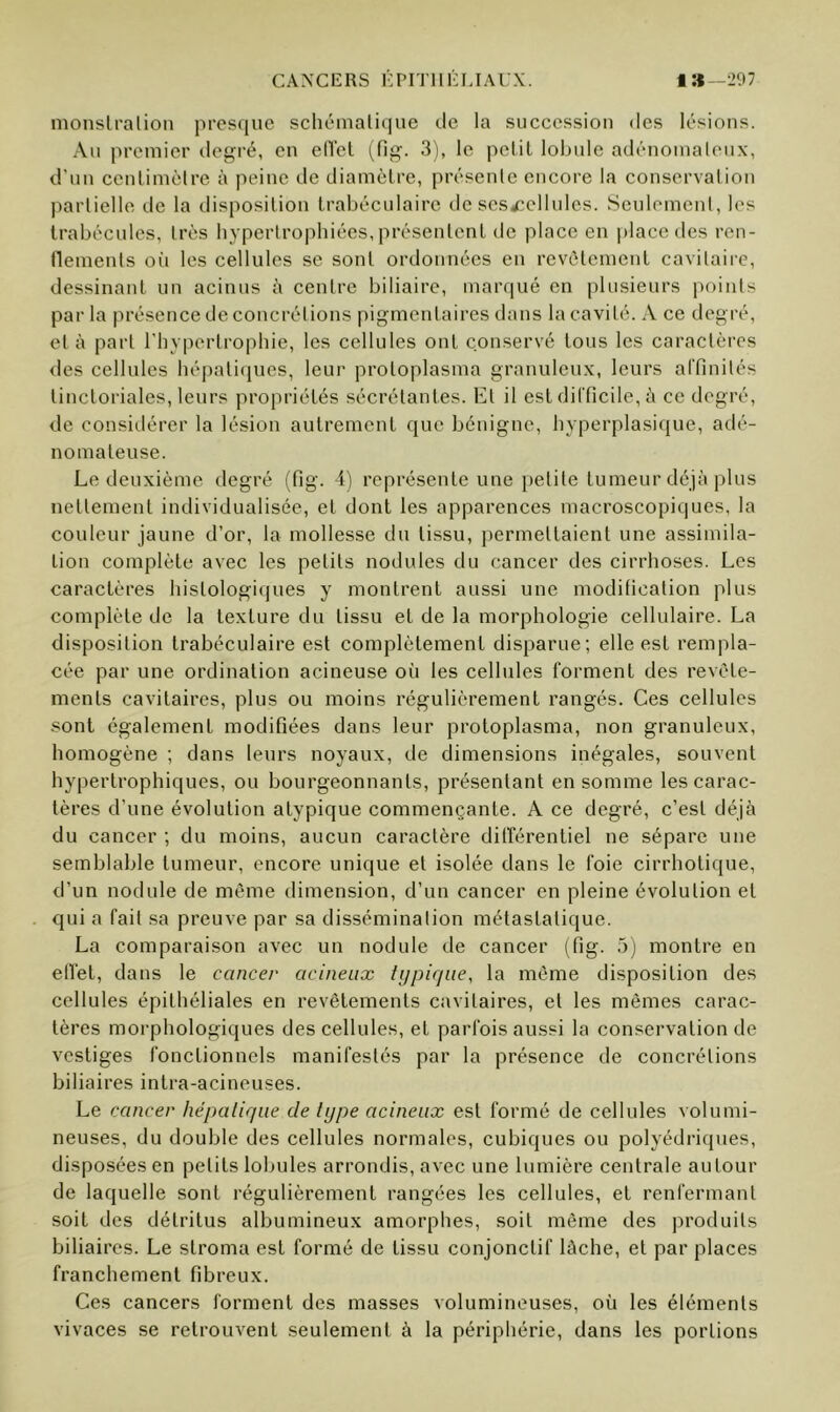 monsLi’alion presque schémalique tle la succession des lésions. Au preniier degré, en elTcl (fig. 3), le pelil lobule adcnoinaleux, d’uu ccnlimèlre à peine de diamèlre, présente encore la conservation partielle de la disposition trabéculaire de scs^ellnles. Seulement, les trabécules, très hypertrophiées, présentent de place en place des ren- flenients où les cellules se sont ordonnées en revêtement cavitaire, dessinant un acinns à centre biliaire, marqué en plusieurs points par la présence de concrétions pigmentaires dans la cavité. A ce degré, et à part l'hyiiertrophie, les cellules ont conservé tons les caractèi'cs des cellules hépaticines, leur proloplasma granulcn.v, leurs alTinilés tinctoriales, leurs propriétés sécrétantes. Et il est difficile, ii ce degré, de considérer la lésion autrement que bénigne, hyperplasique, adé- nomateuse. Le deuxième degré (fig. 4) représente une petite tumeur déjà plus nettement individualisée, et dont les apparences macroscopiques, la couleur jaune d’or, la mollesse du tissu, permettaient une assimila- tion complète avec les petits nodules du cancer des cirrhoses. Les caractères histologi(|ues y montrent aussi une modification plus complète de la texture du tissu et de la morphologie cellulaire. La disposition trabéculaire est complètement disparue; elle est rempla- cée par une ordination acineuse où les cellules forment des revête- ments cavitaires, plus ou moins régulièrement rangés. Ces cellules sont également modifiées dans leur protoplasma, non granuleux, homogène ; dans leurs noyaux, de dimensions inégales, souvent hypertrophiques, ou bourgeonnants, présentant en somme les carac- tères d’une évolution atypique commençante. A ce degré, c’est déjà du cancer ; du moins, aucun caractère différentiel ne sépare une semblable tumeur, encore unique et isolée dans le foie cirrhotique, d’un nodule de même dimension, d’un cancer en pleine évolution et qui a fait sa preuve par sa dissémination métastatique. La comparaison avec un nodule de cancer (fig. 5) montre en effet, dans le cancer acineux typique, la même disposition des cellules épithéliales en revêtements cavitaires, et les mêmes carac- tères morphologiques des cellules, et parfois aussi la conservation de vestiges fonctionnels manifestés par la présence de concrétions biliaires intra-acineuses. Le cancer hépatique de type acineux est formé de cellules volumi- neuses, du double des cellules normales, cubiques ou polyédriques, disposées en petits lobules arrondis, avec une lumière centrale autour de laquelle sont régulièrement rangées les cellules, et renfermant soit des détritus albumineux amorphes, soit même des produits biliaires. Le stroma est formé de tissu conjonctif lâche, et par places franchement fibreux. Ces cancers forment des masses volumineuses, où les éléments vivaces se retrouvent seulement à la périphérie, dans les portions